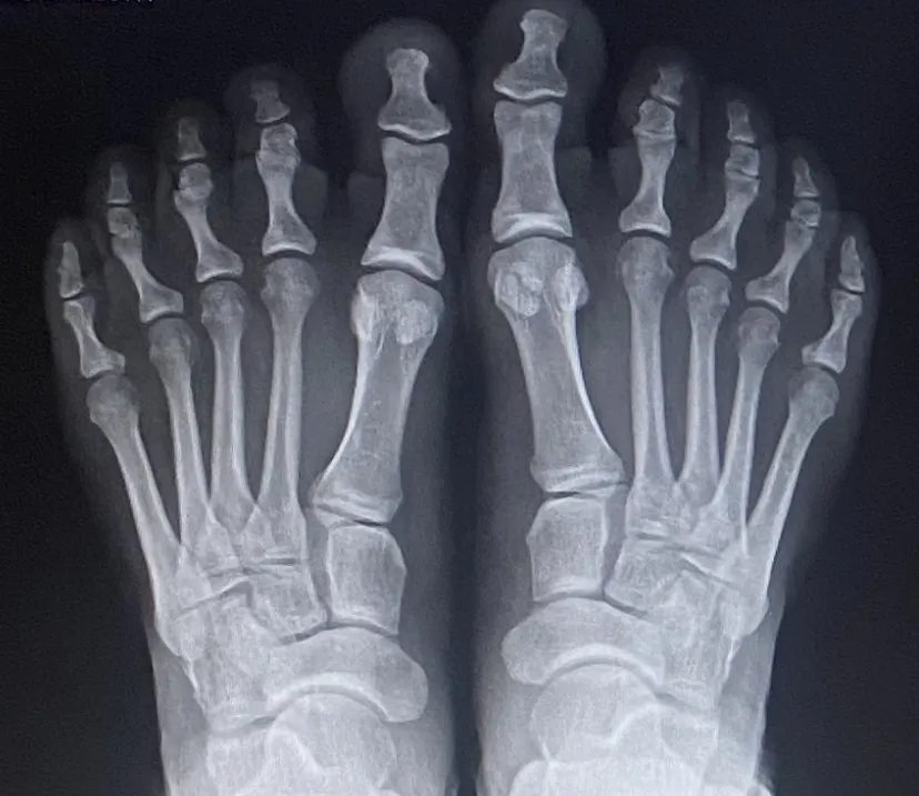 BBfeet OnlyFans profile picture