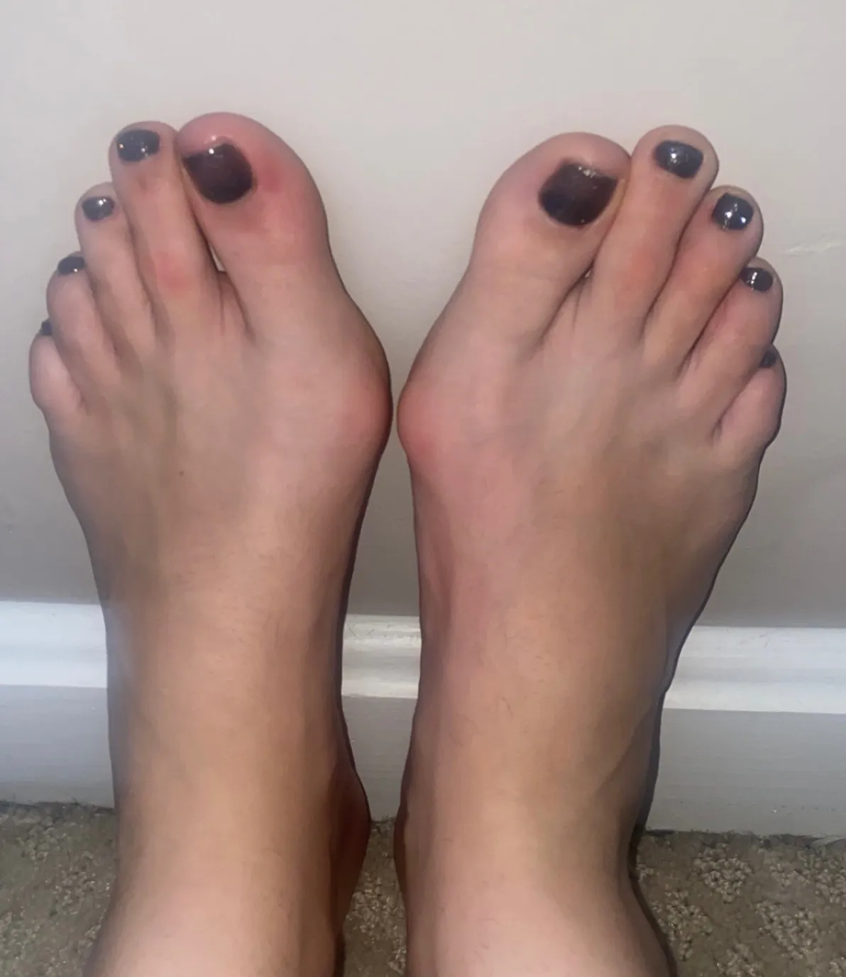 Feet pics &amp; more