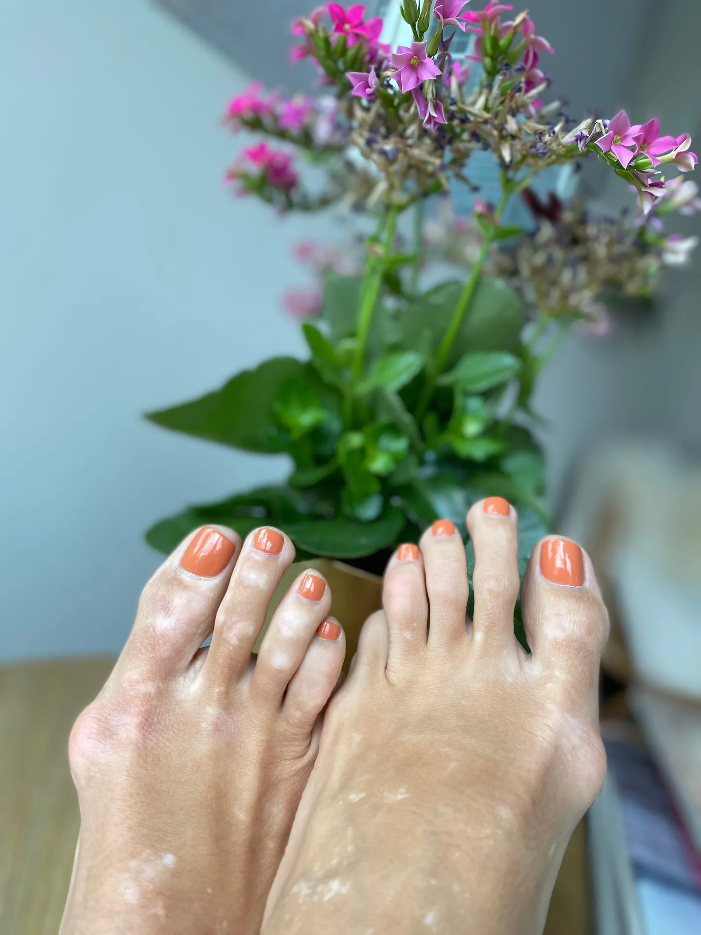 Bunion Babe 🦶🏼