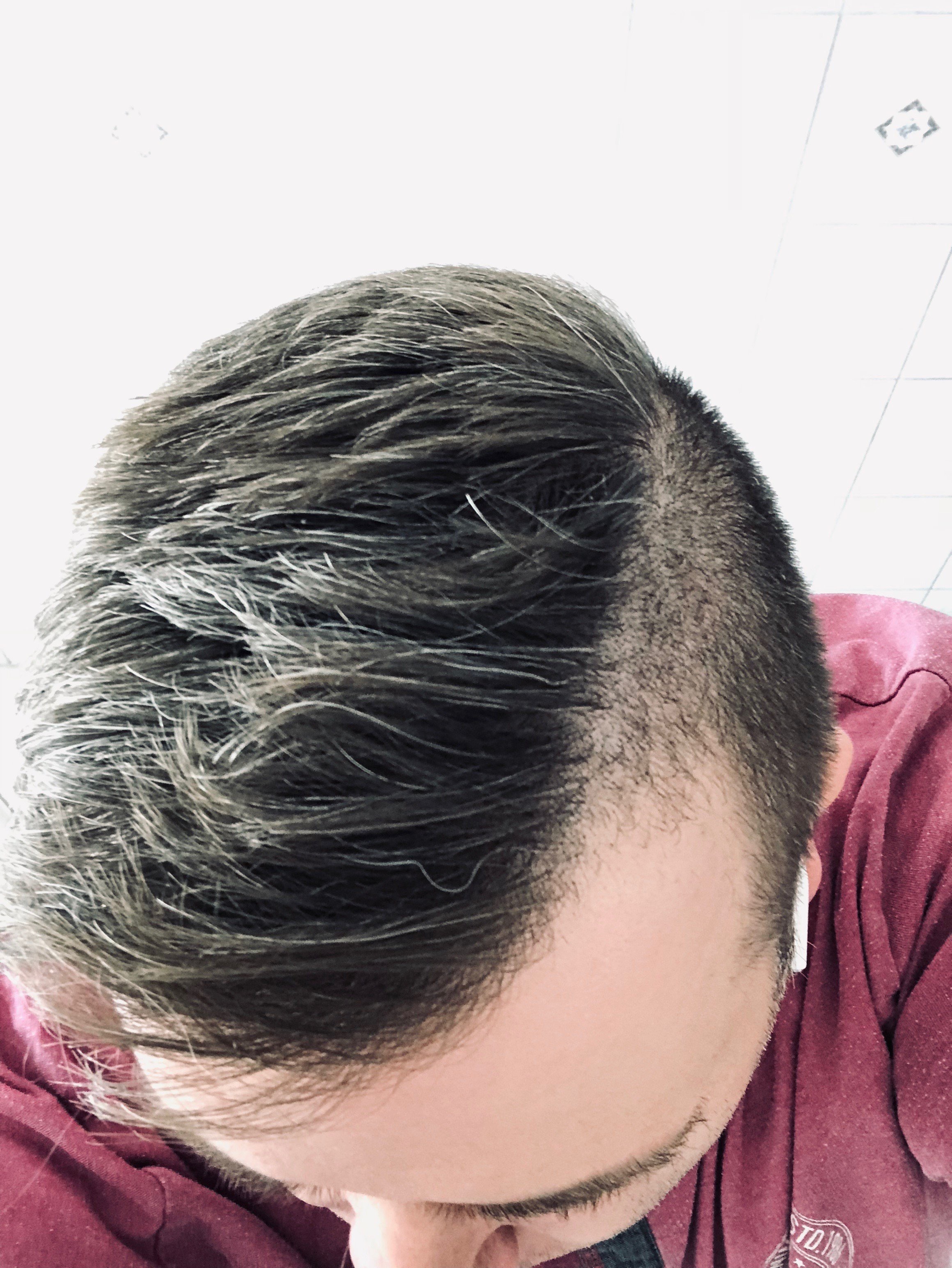 DieserChriss OnlyFans