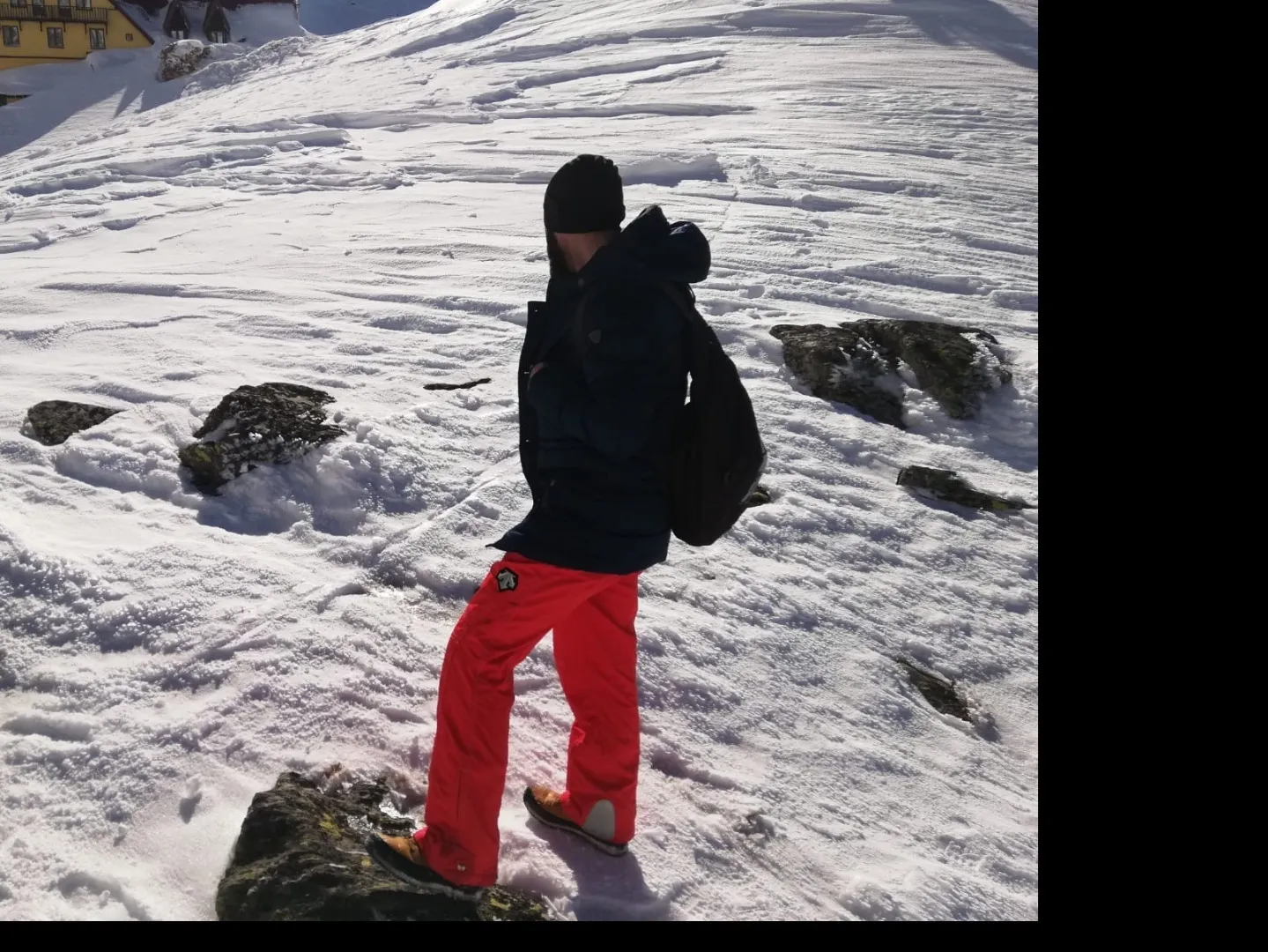 Anonim OnlyFans header