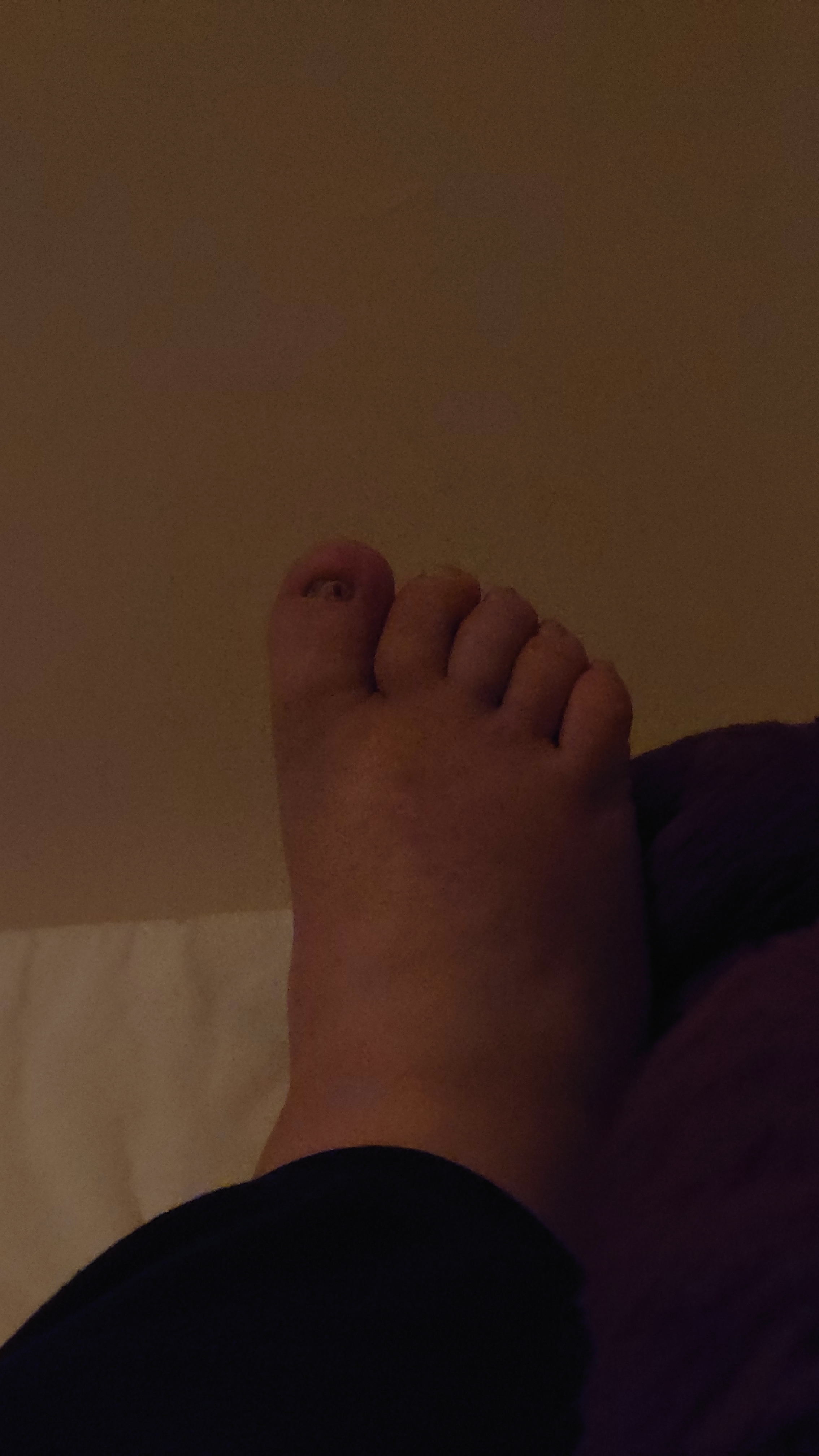 Fat feet. OnlyFans header