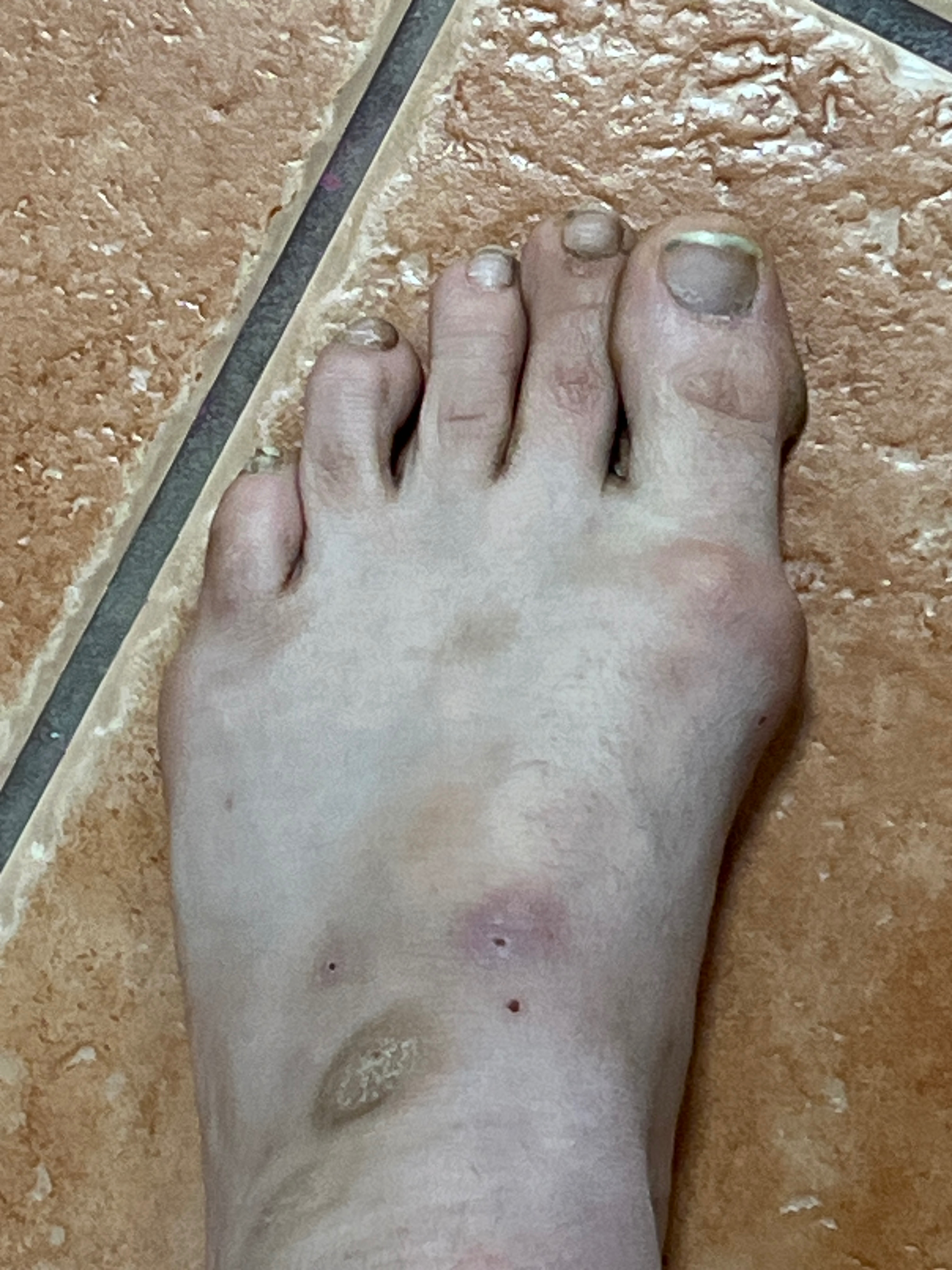 F*cking Disgusting Feet OnlyFans