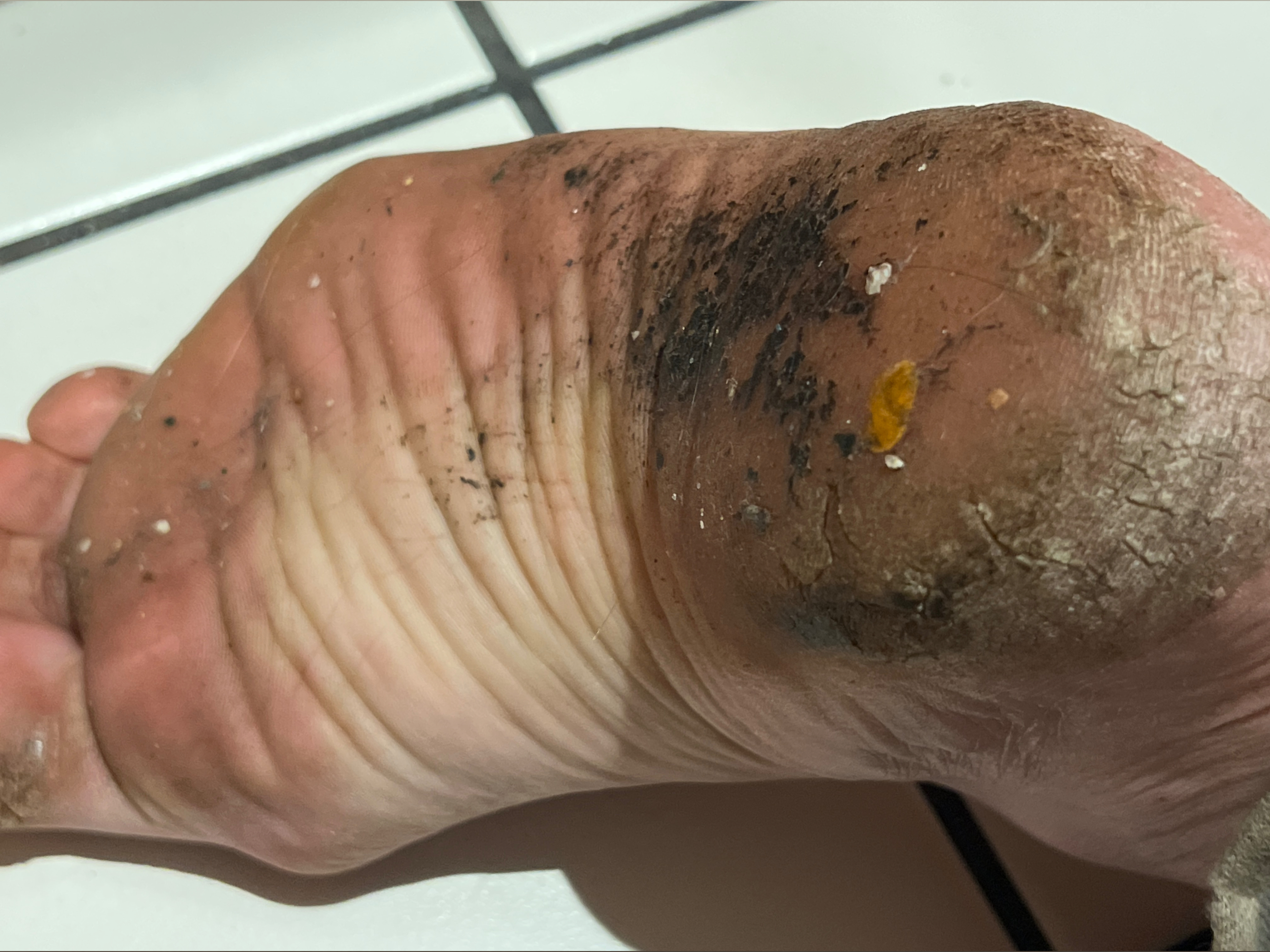 F*cking Disgusting Feet OnlyFans header