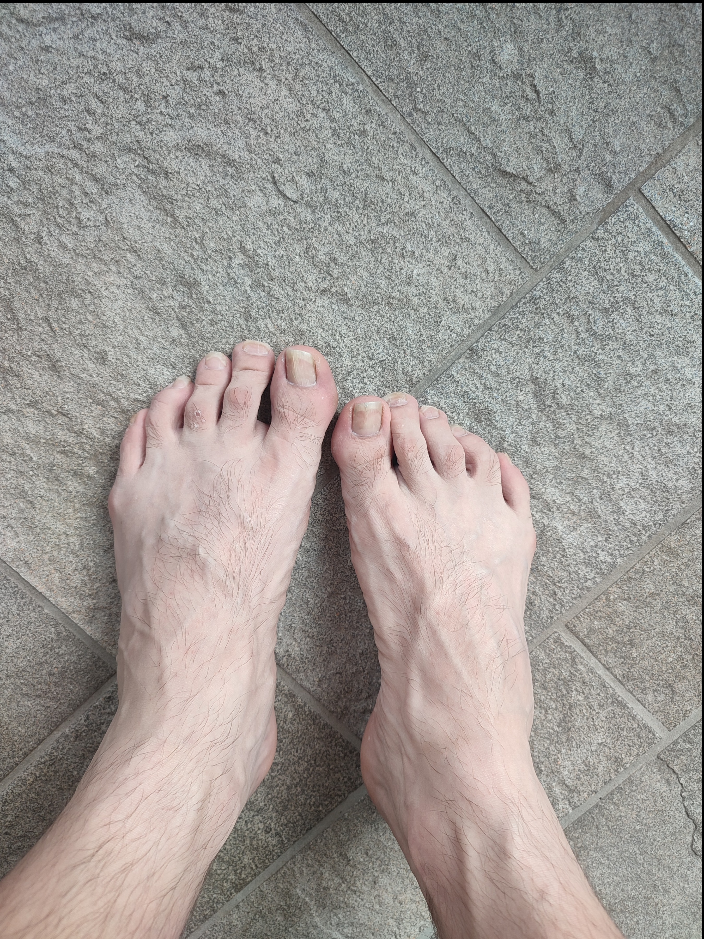 Feet Fetish OnlyFans