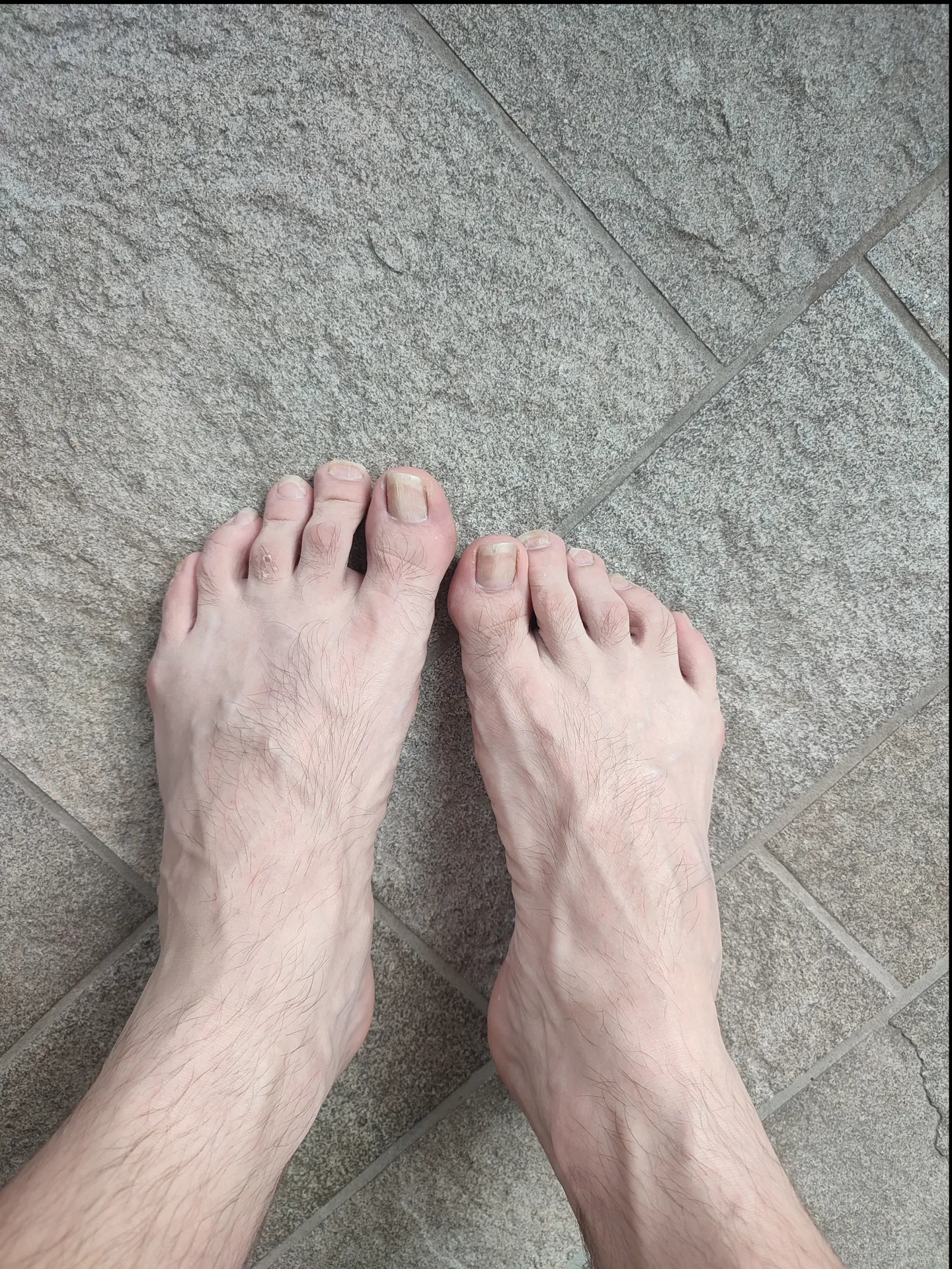 Feet Fetish