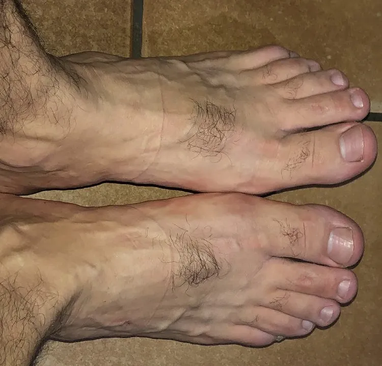 Feet.mg cover