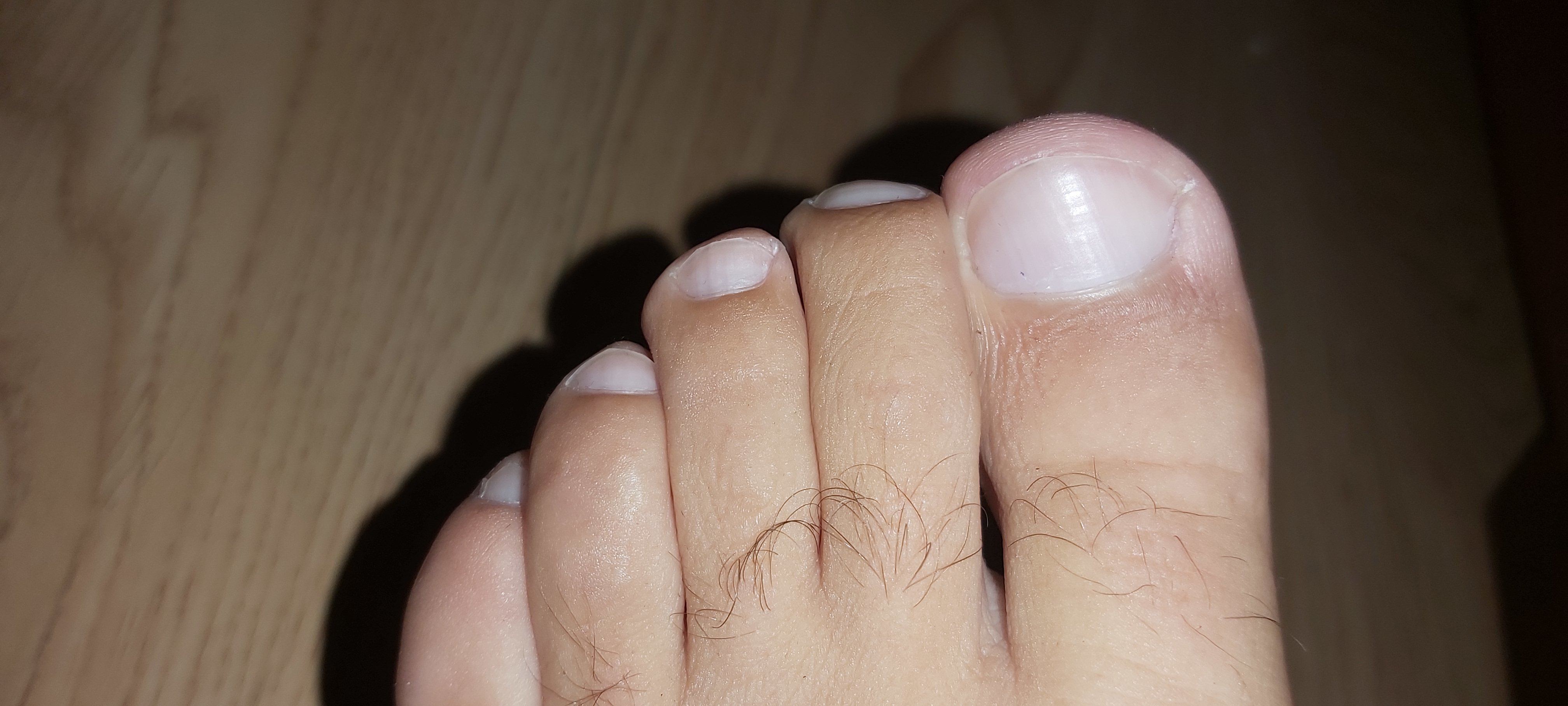 Feet fantasises for you. OnlyFans