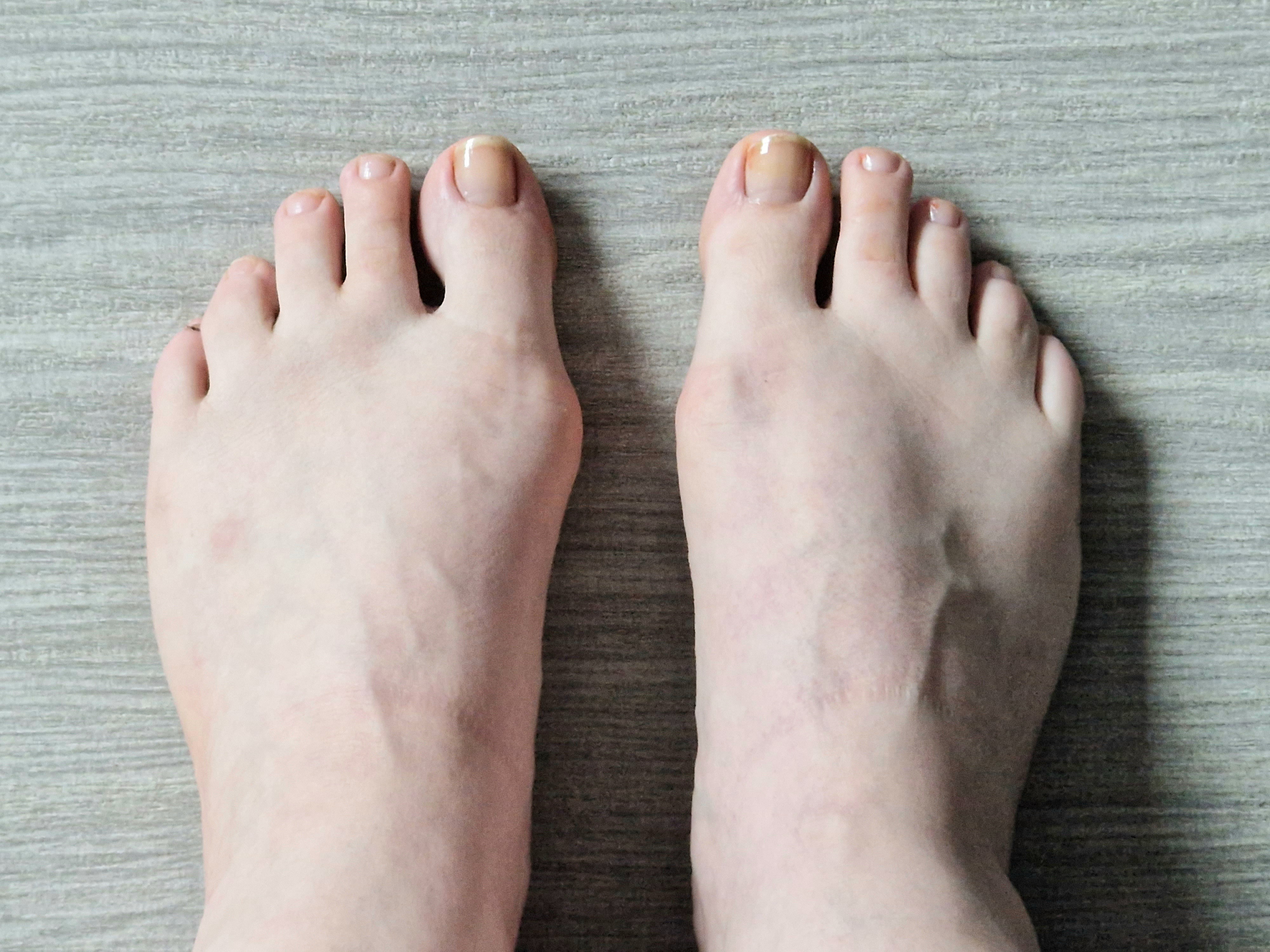 feetbunionsforyou OnlyFans header