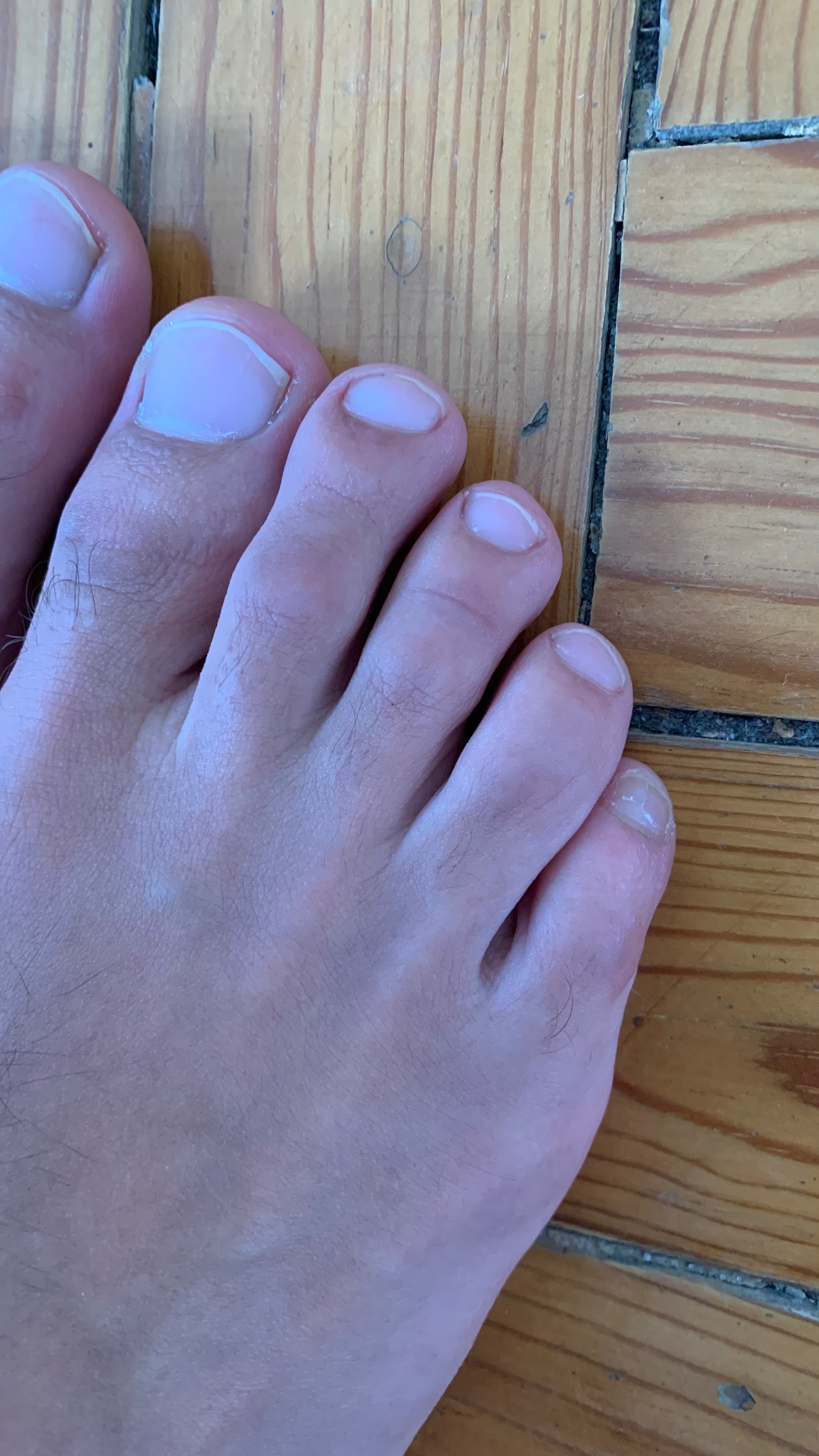feetbyrodrigo OnlyFans