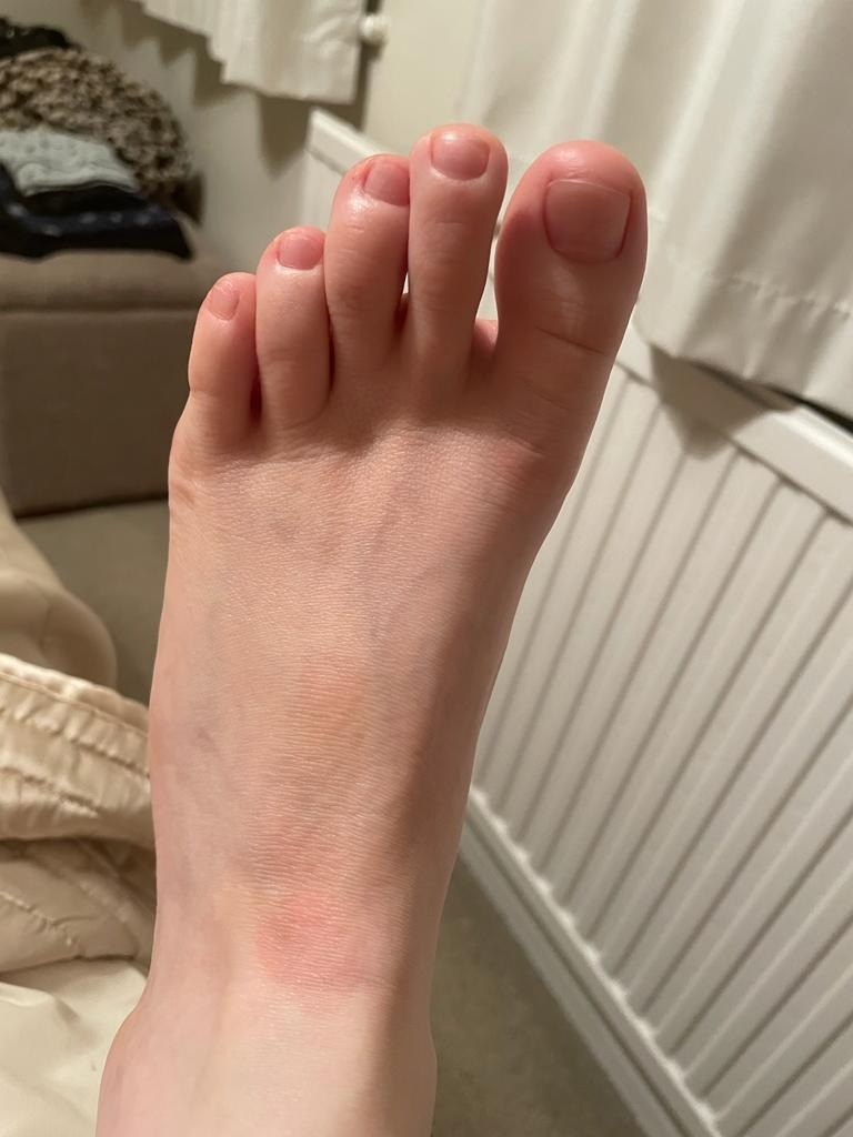 Bubble toes OnlyFans