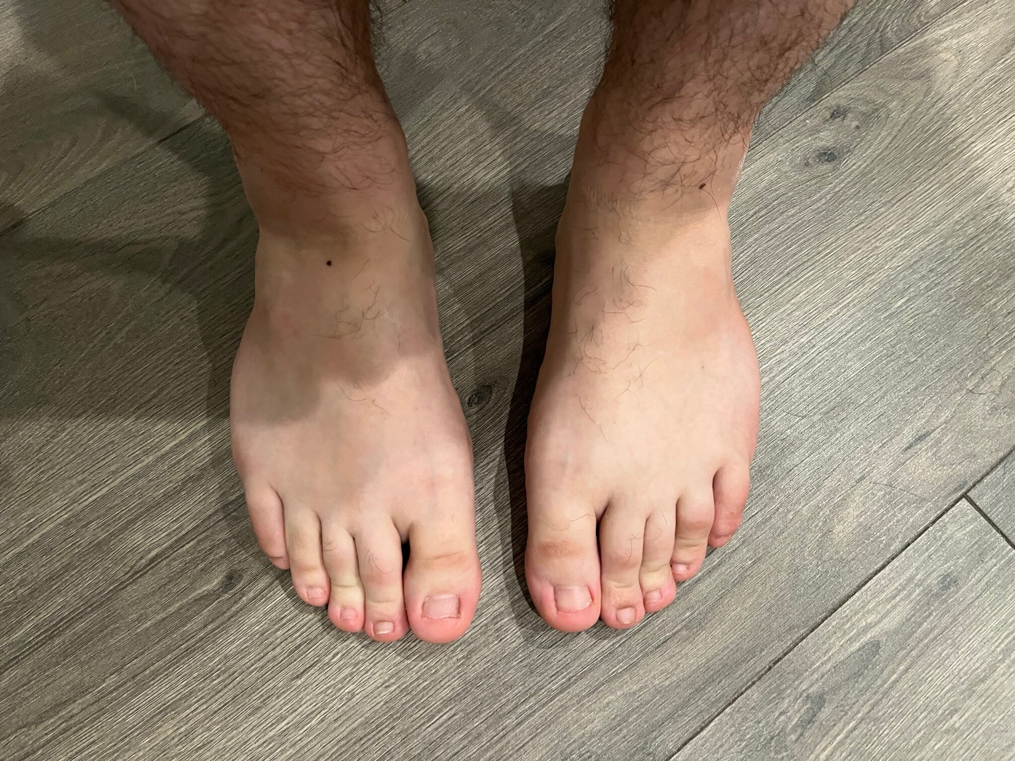 FeetForFapping OnlyFans