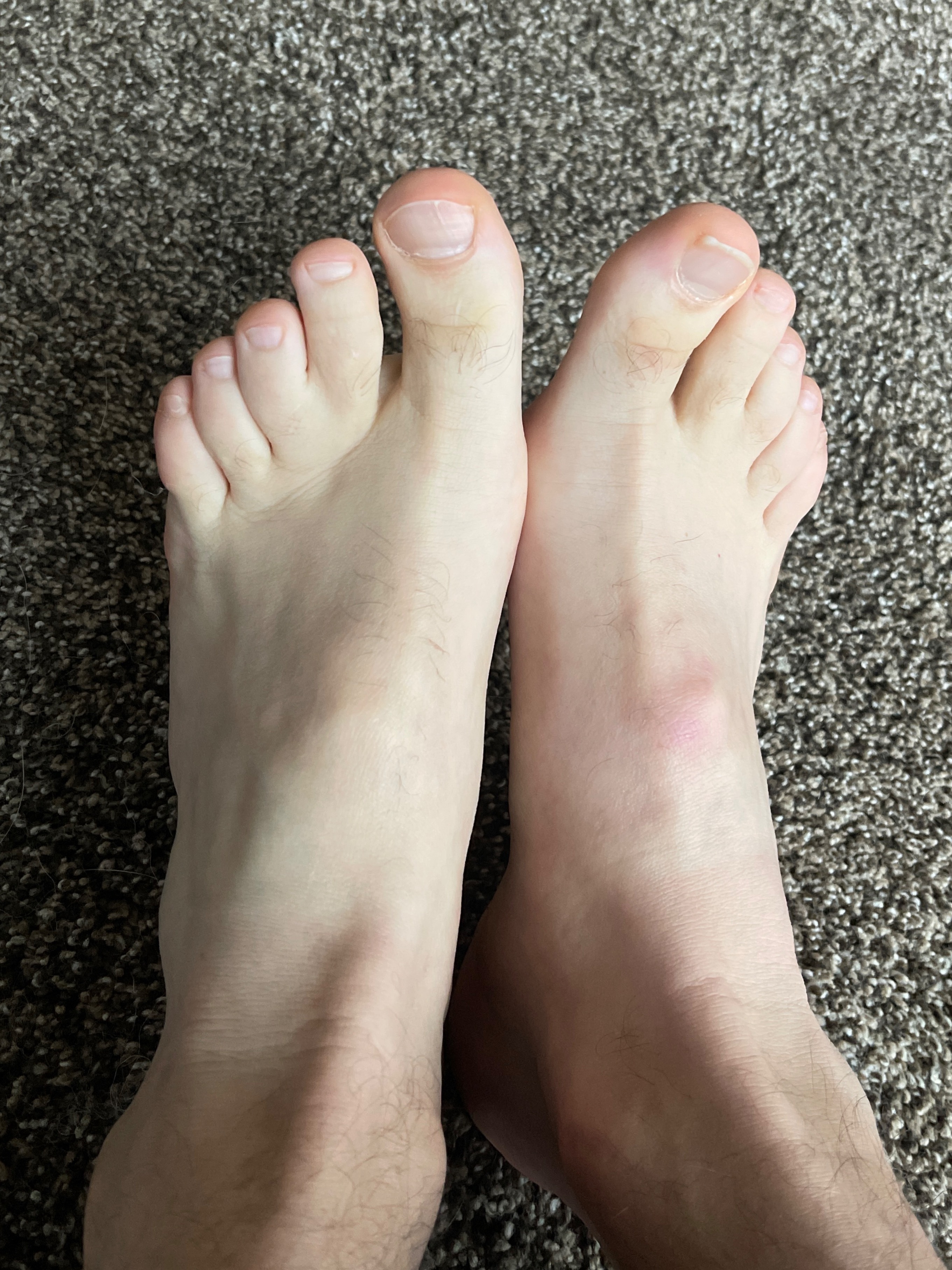 No Socks No Problem OnlyFans