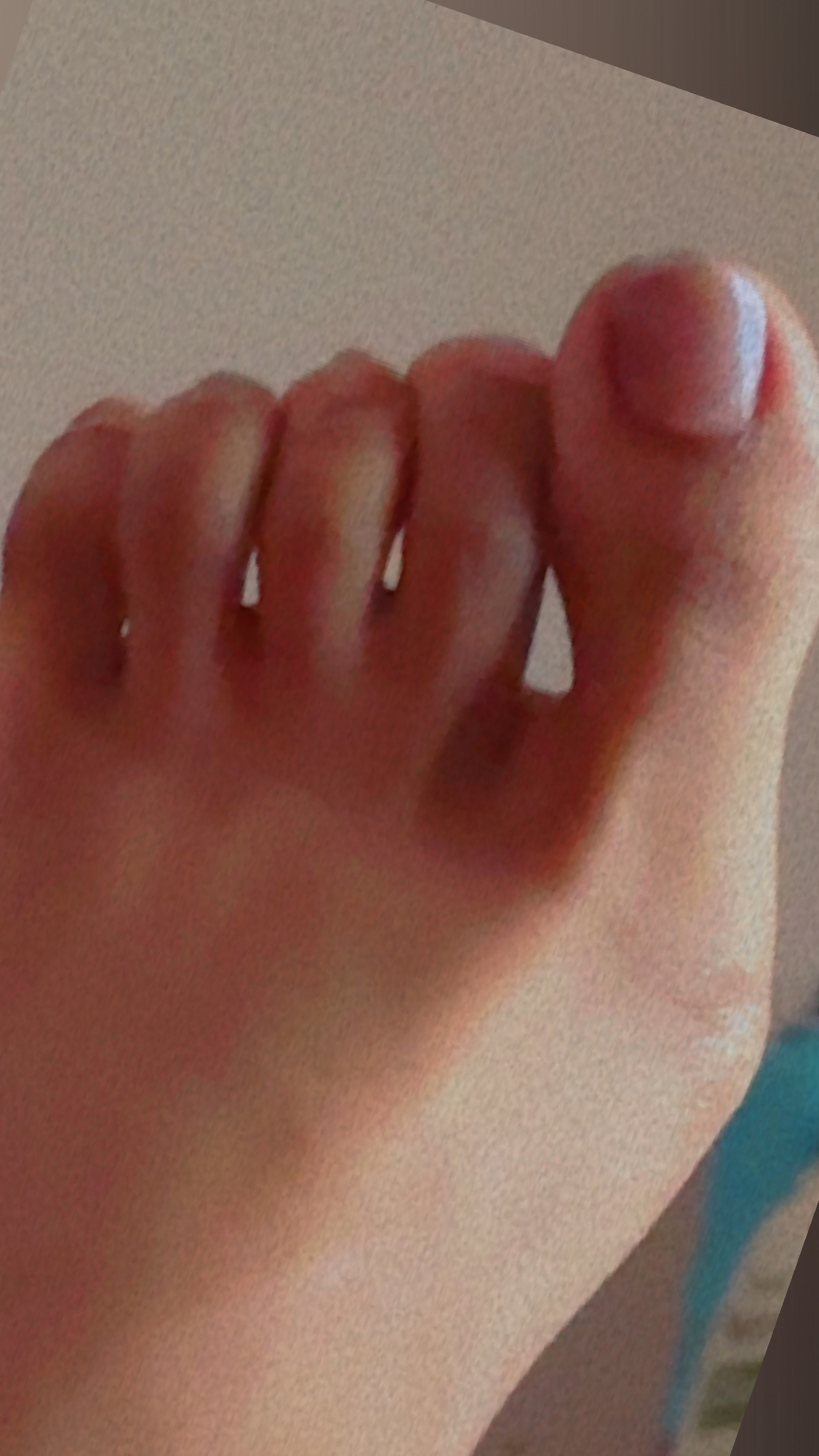 Pretty 🦶 With A Twist OnlyFans