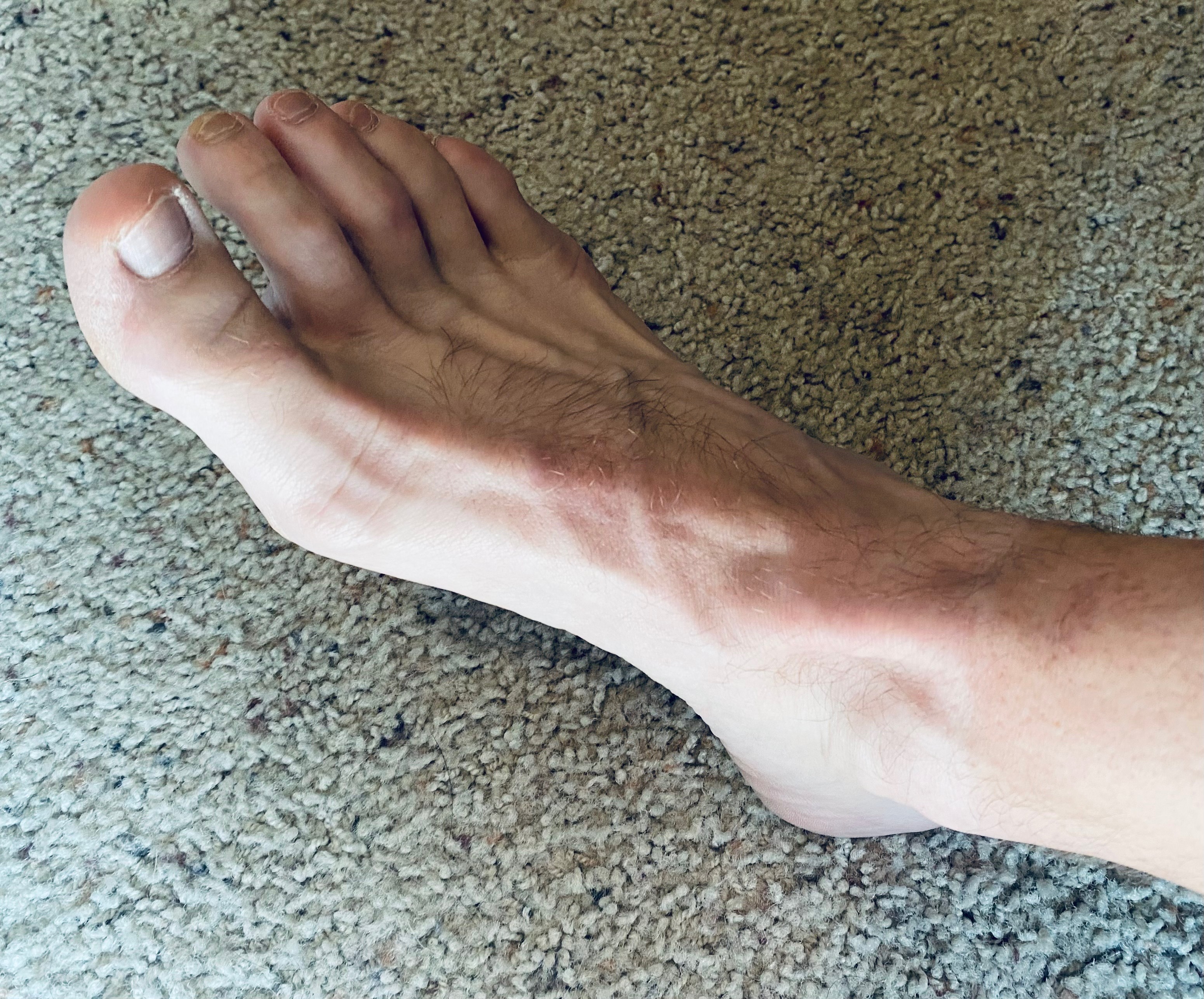 Feet of Puss OnlyFans