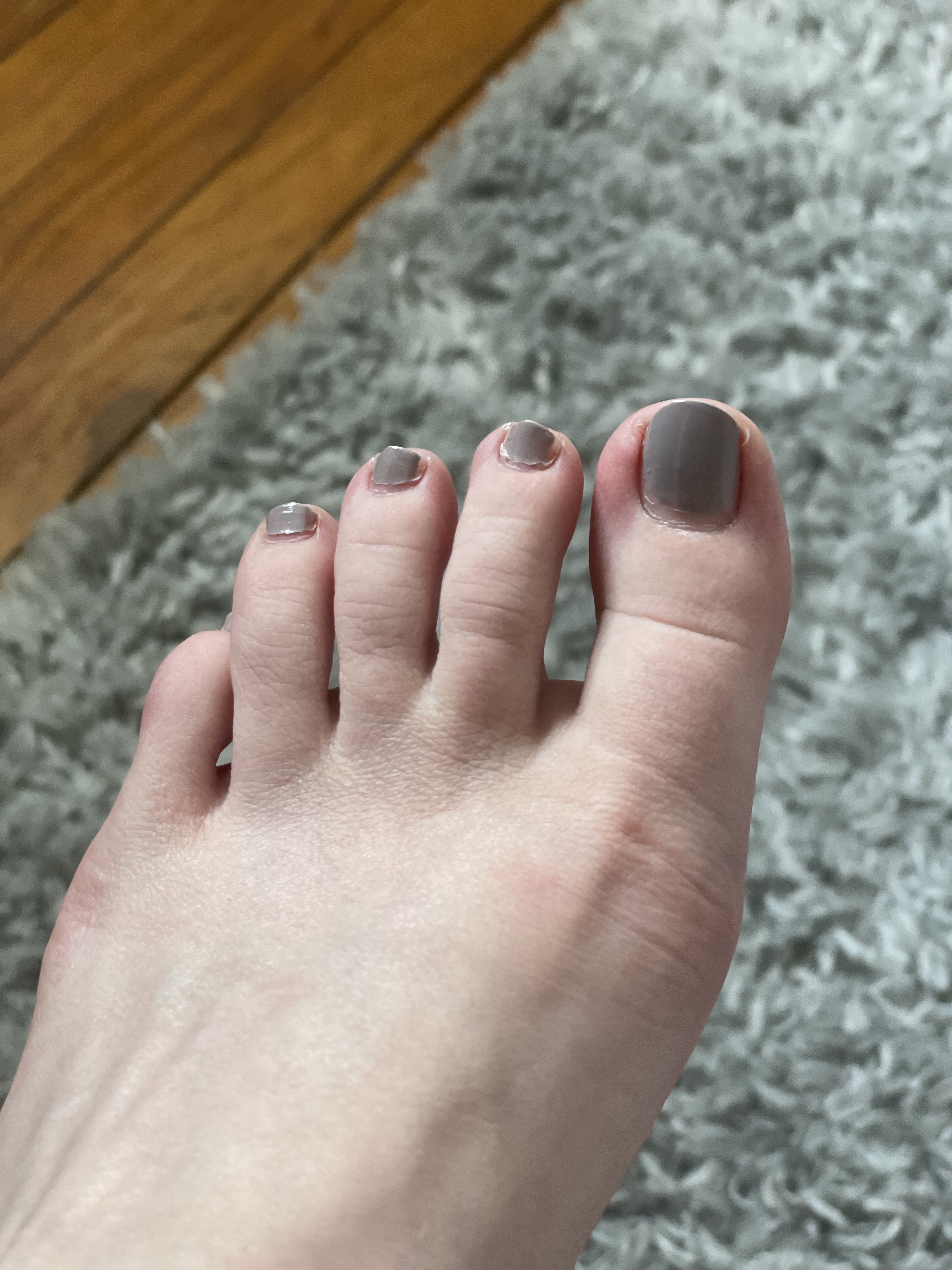 ✨FEET PICS✨ OnlyFans