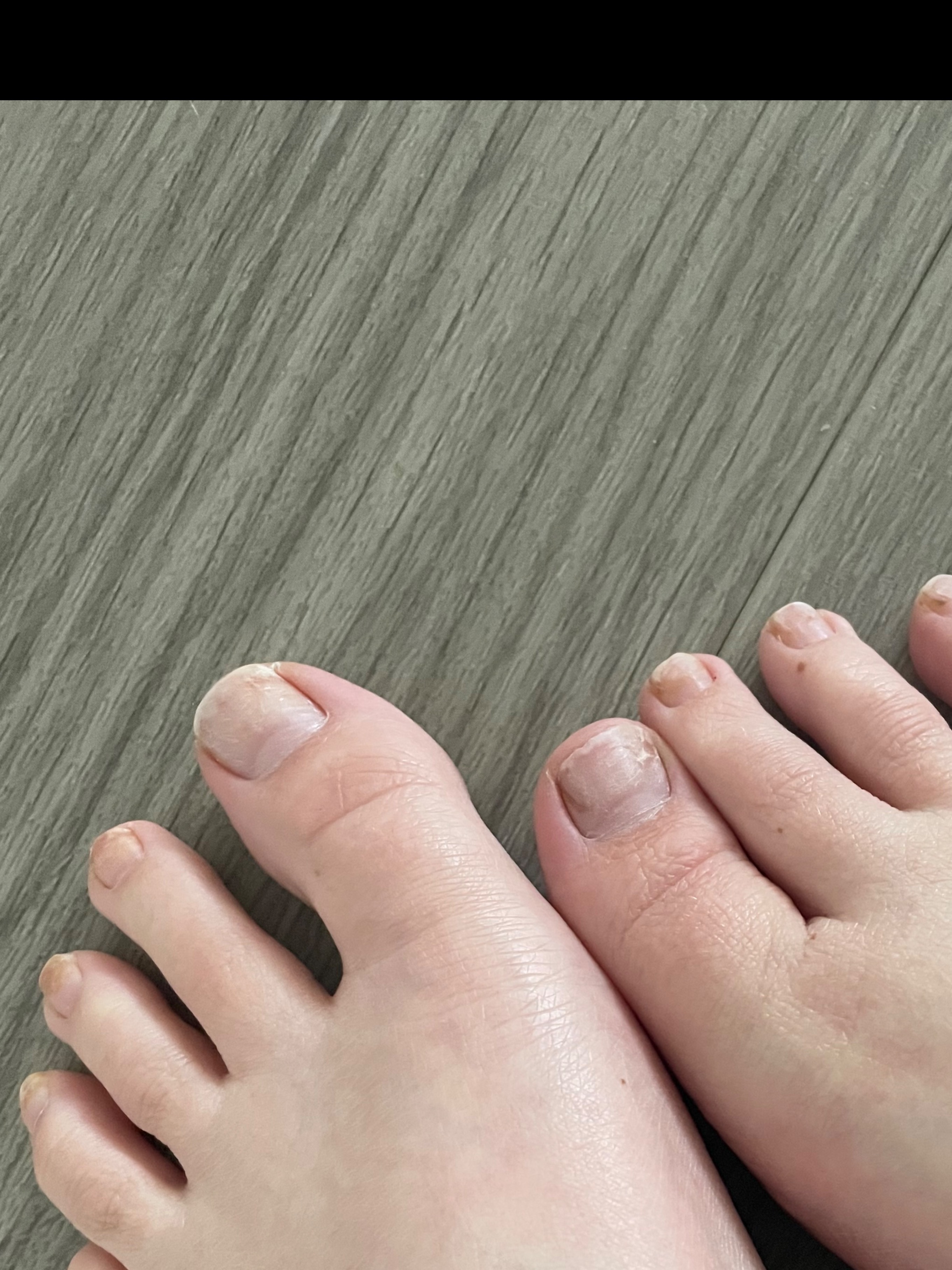 Personalised feet pictures 🫢 OnlyFans header