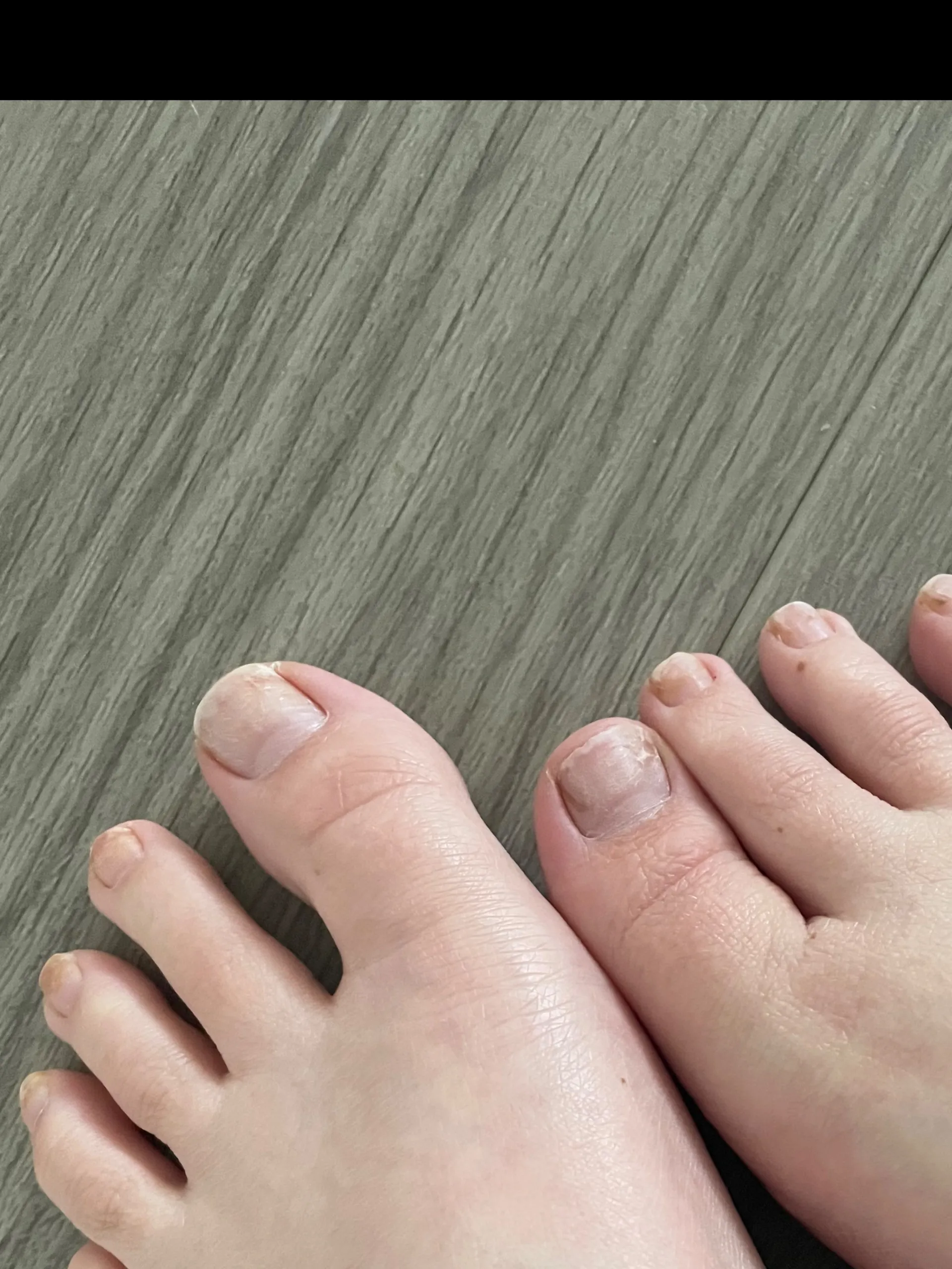 Personalised feet pictures 🫢 OnlyFans header