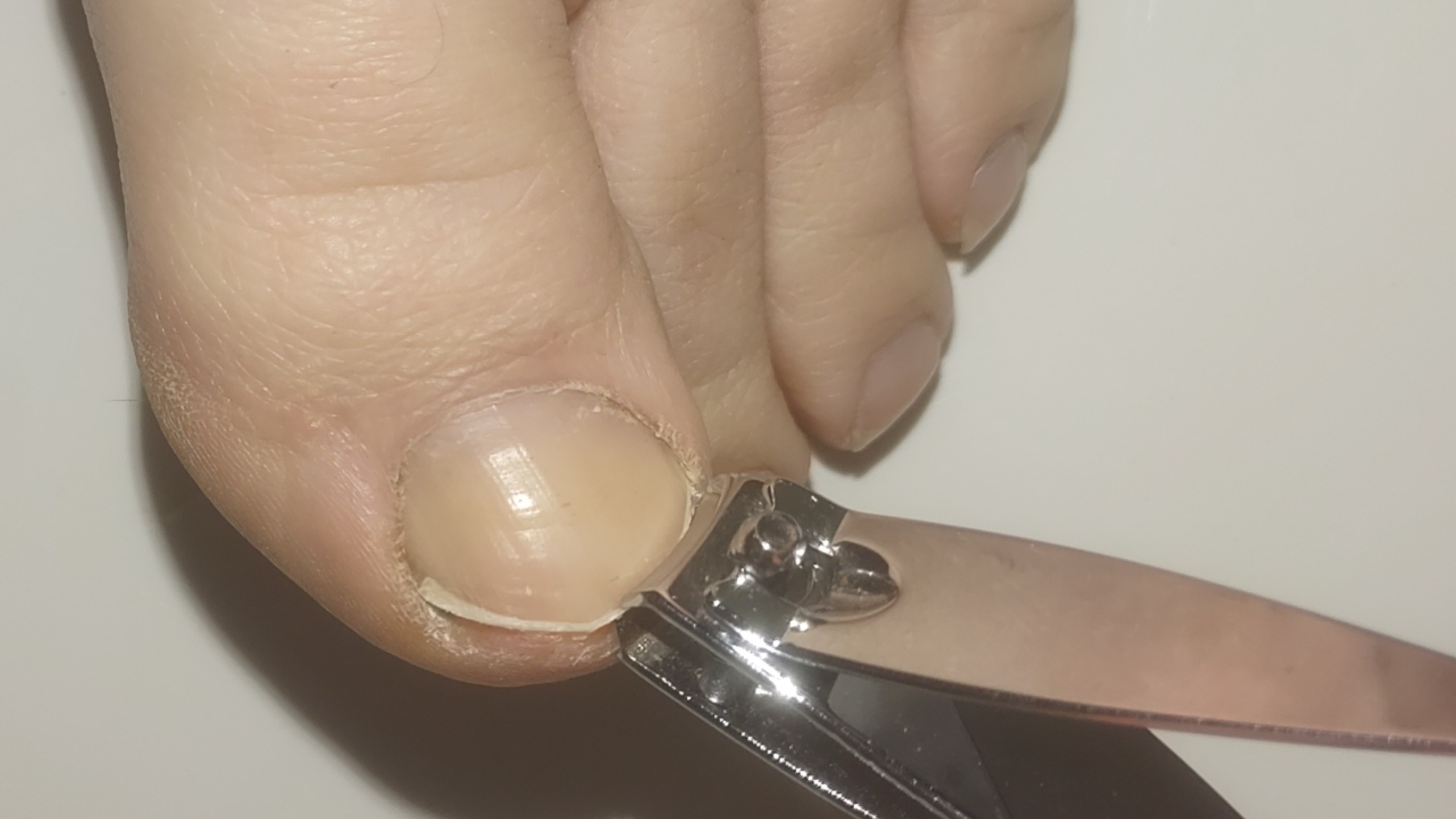 Feet Pictures Unlimited OnlyFans