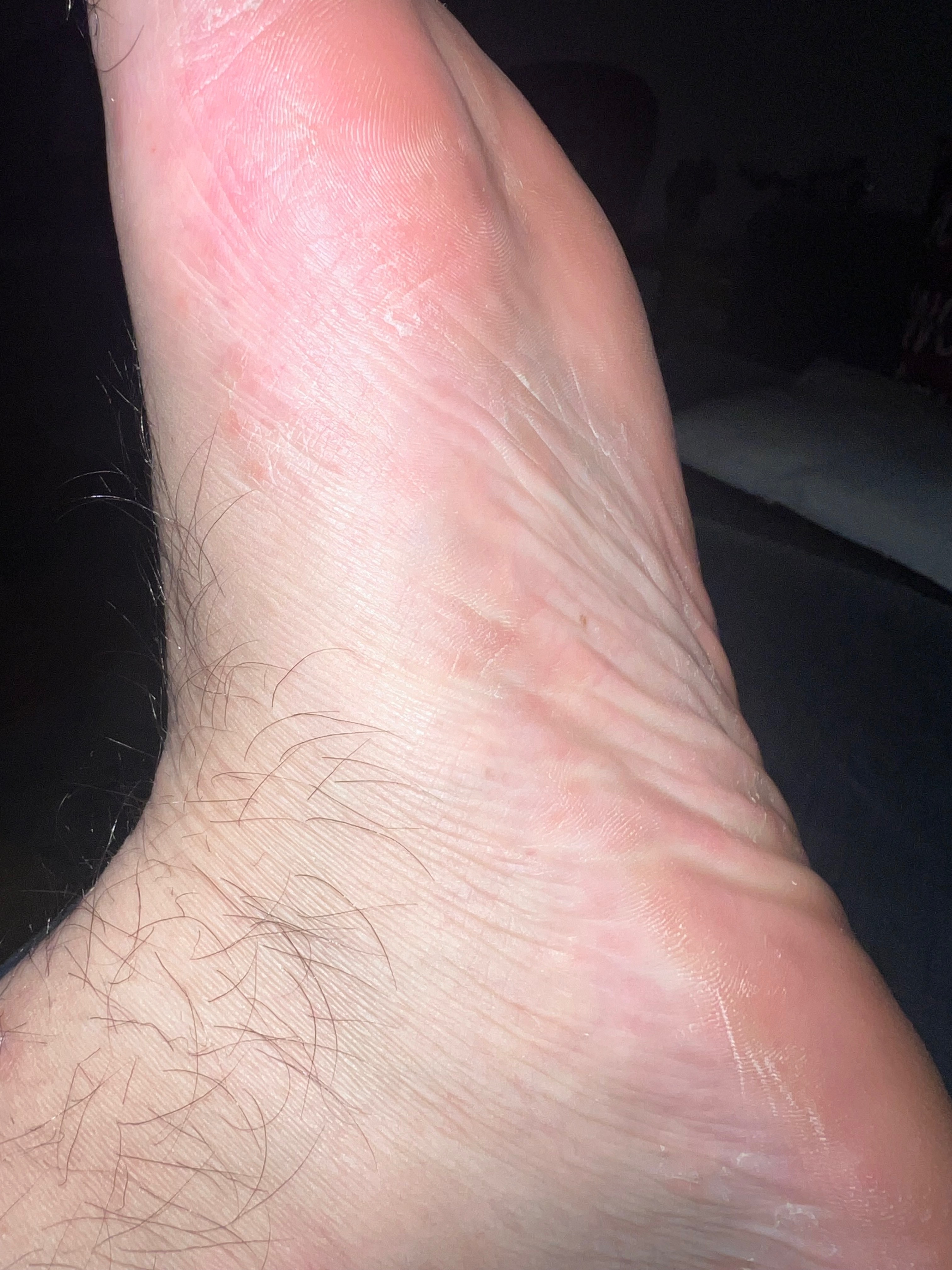 Feet stripper OnlyFans