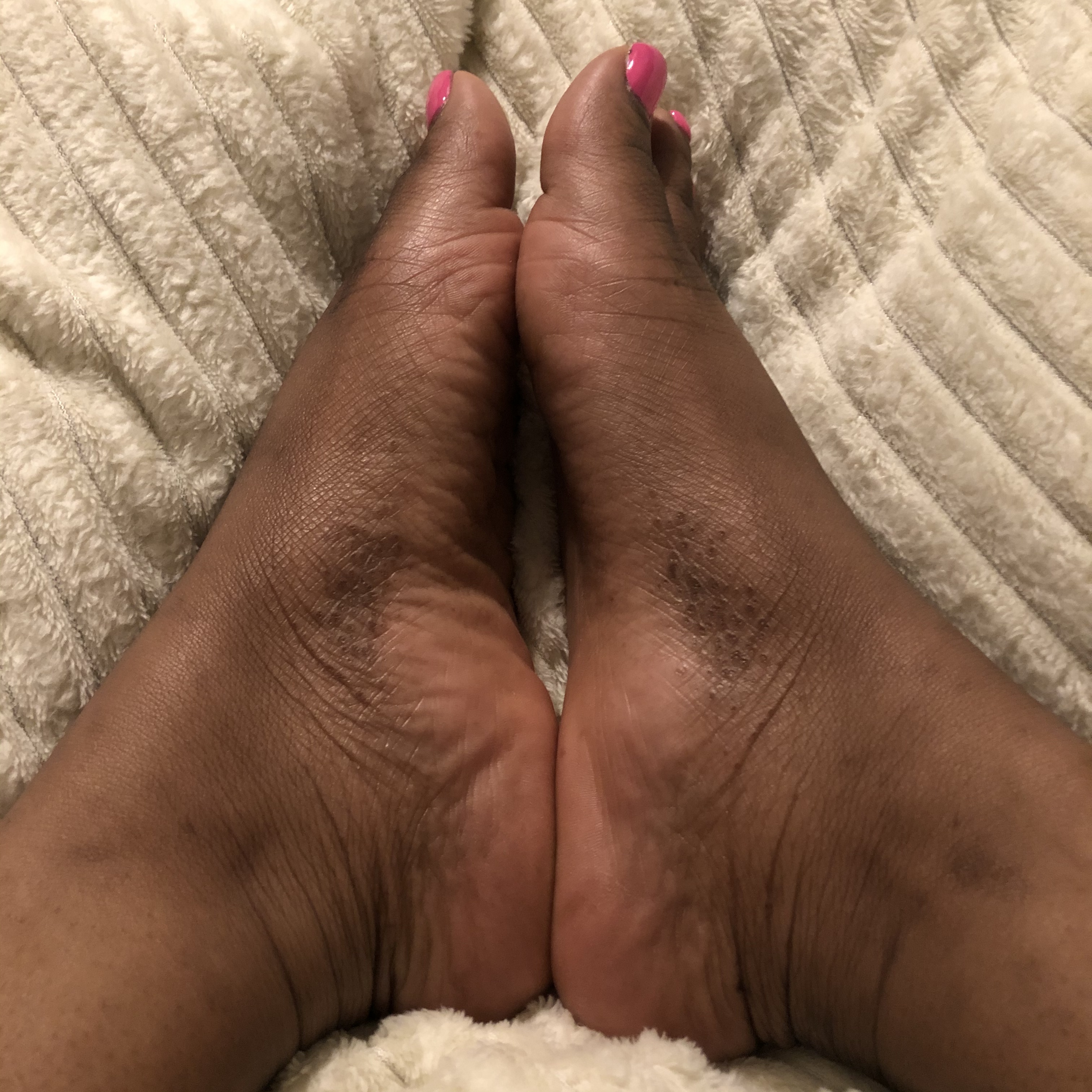 Feet treats OnlyFans header
