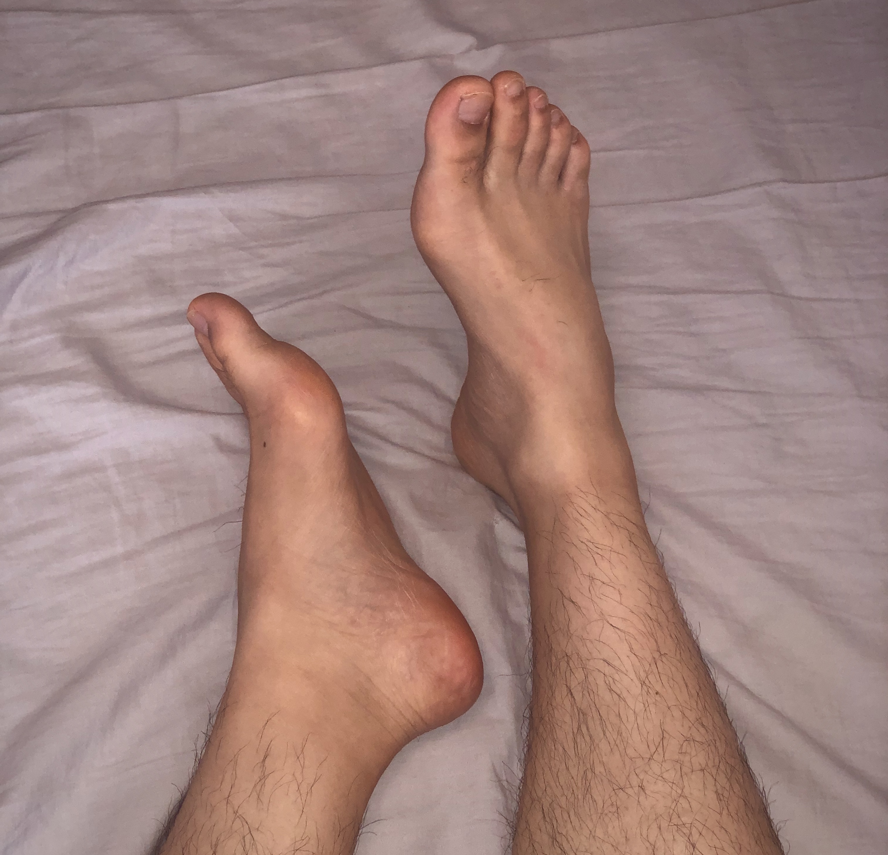 FinnsFeet OnlyFans