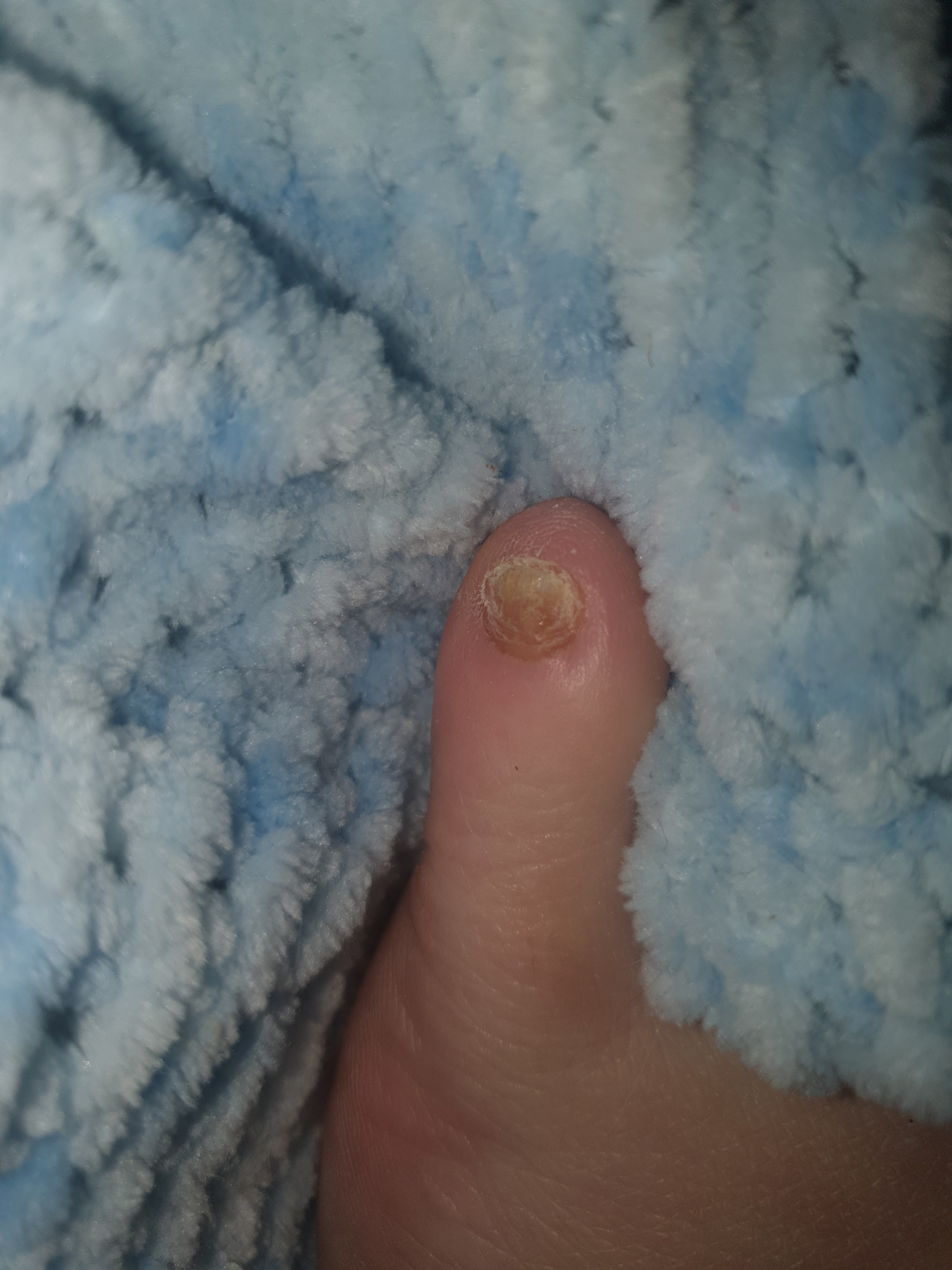 Felicity feetdal OnlyFans