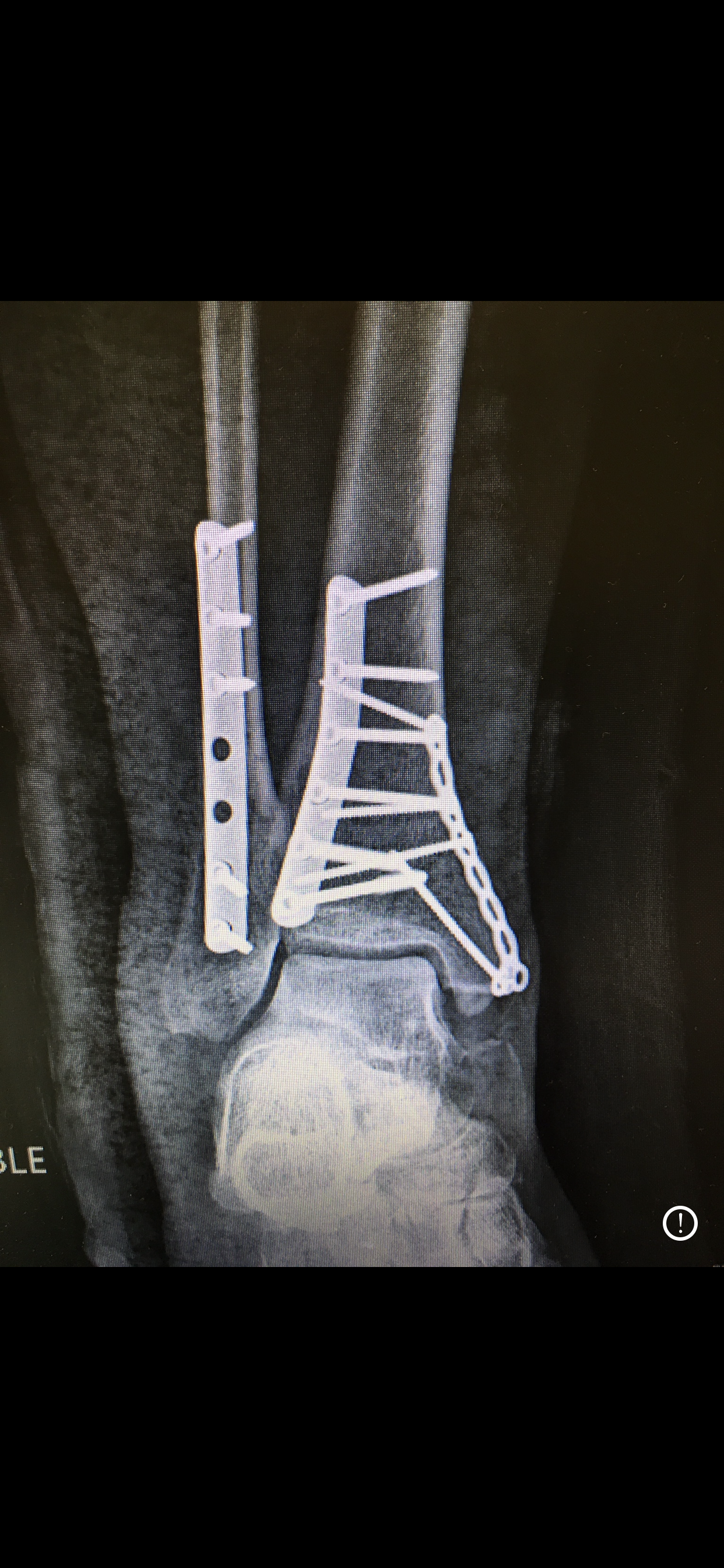 Glenn Weinraub OnlyFans