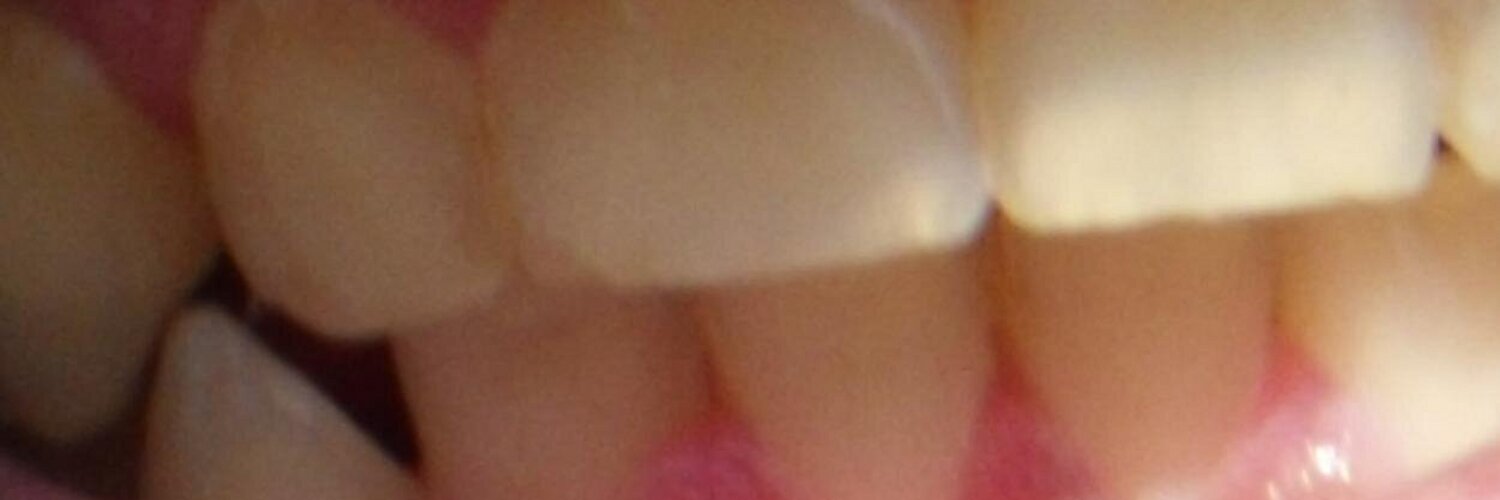 Freak77Show OnlyFans header