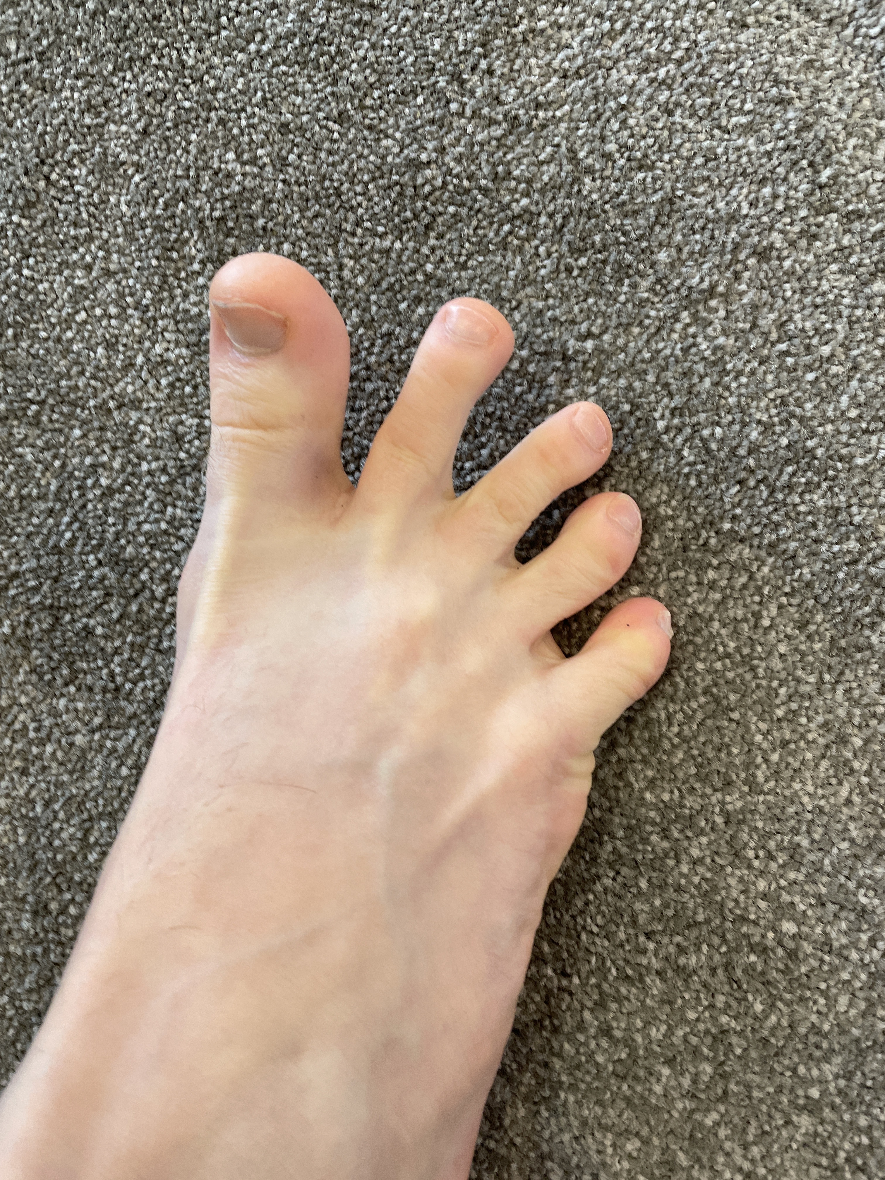 Freak Feet 69
