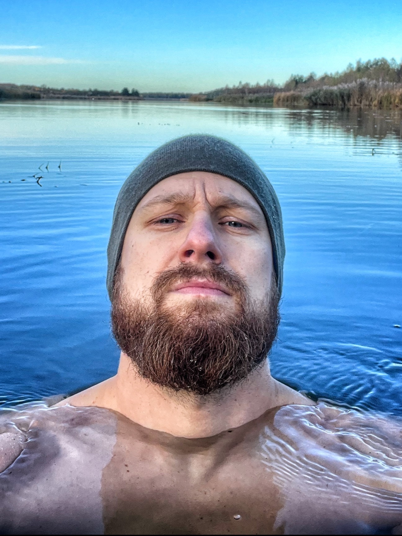 Fritz Meinecke OnlyFans