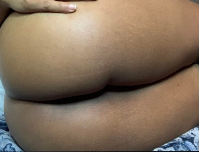 La manzanita de la discordia OnlyFans