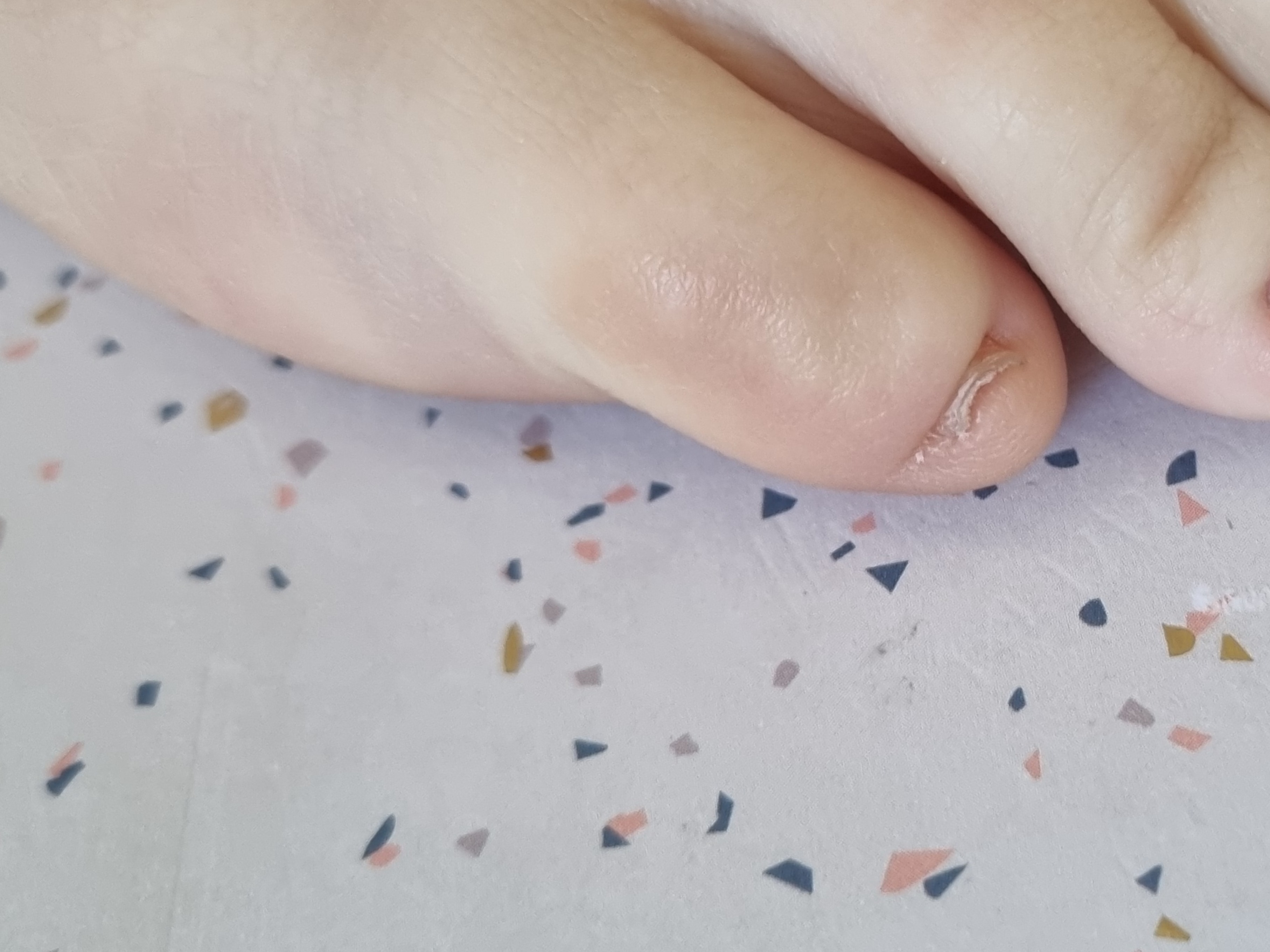 Mrs Prawn Toe OnlyFans