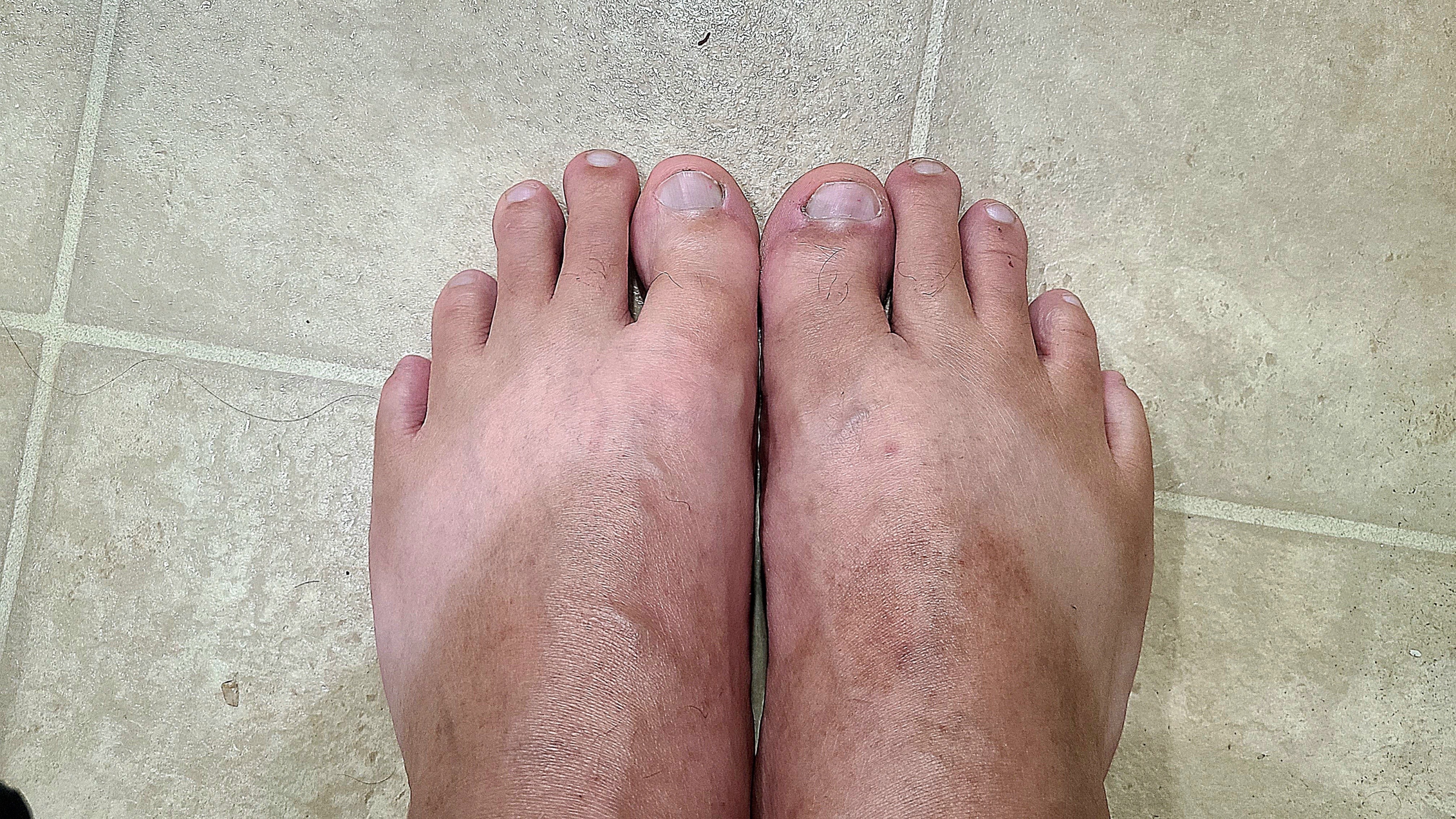 OnlyDeesFeets OnlyFans