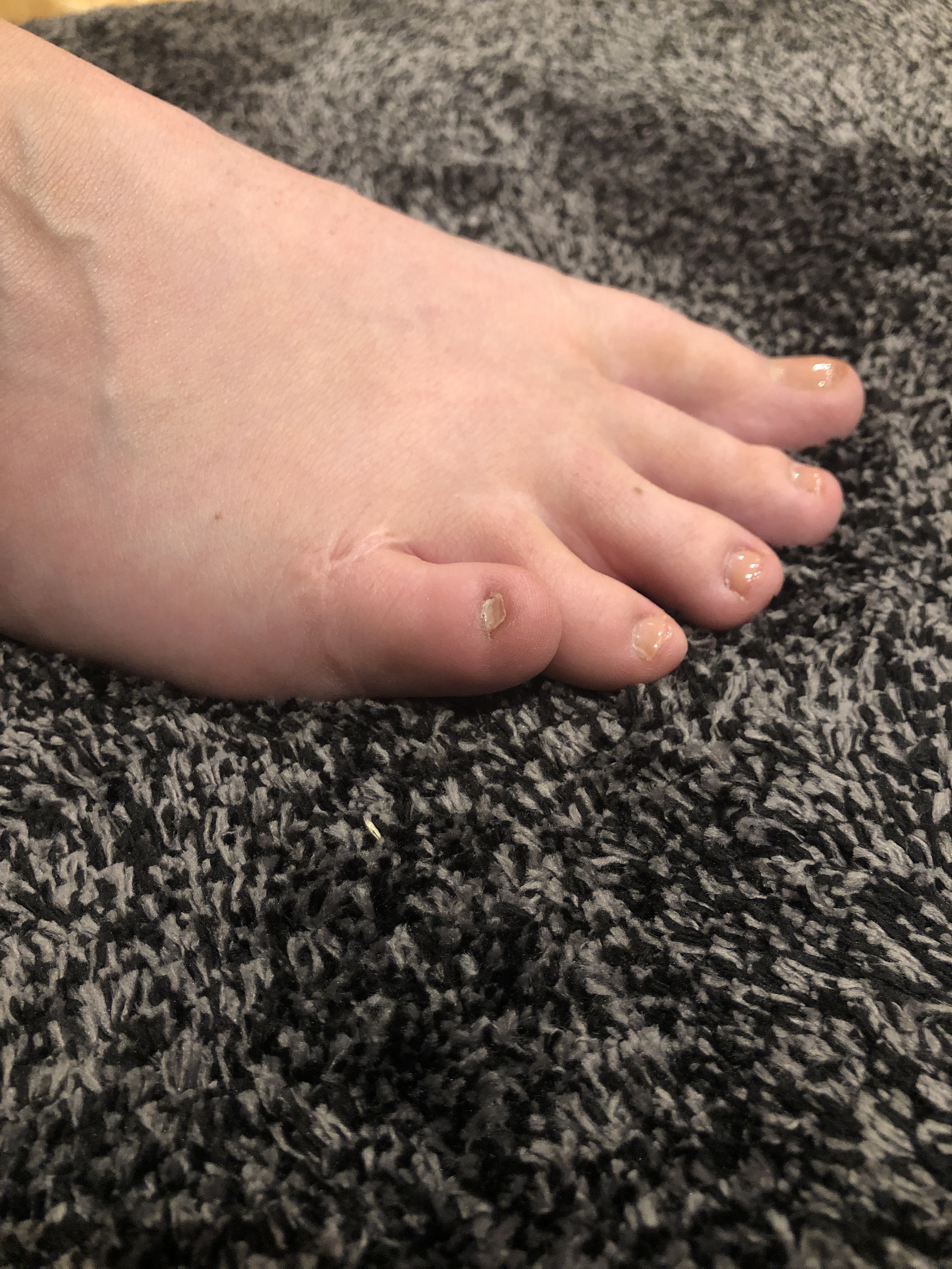 Felicity Jones OnlyFans