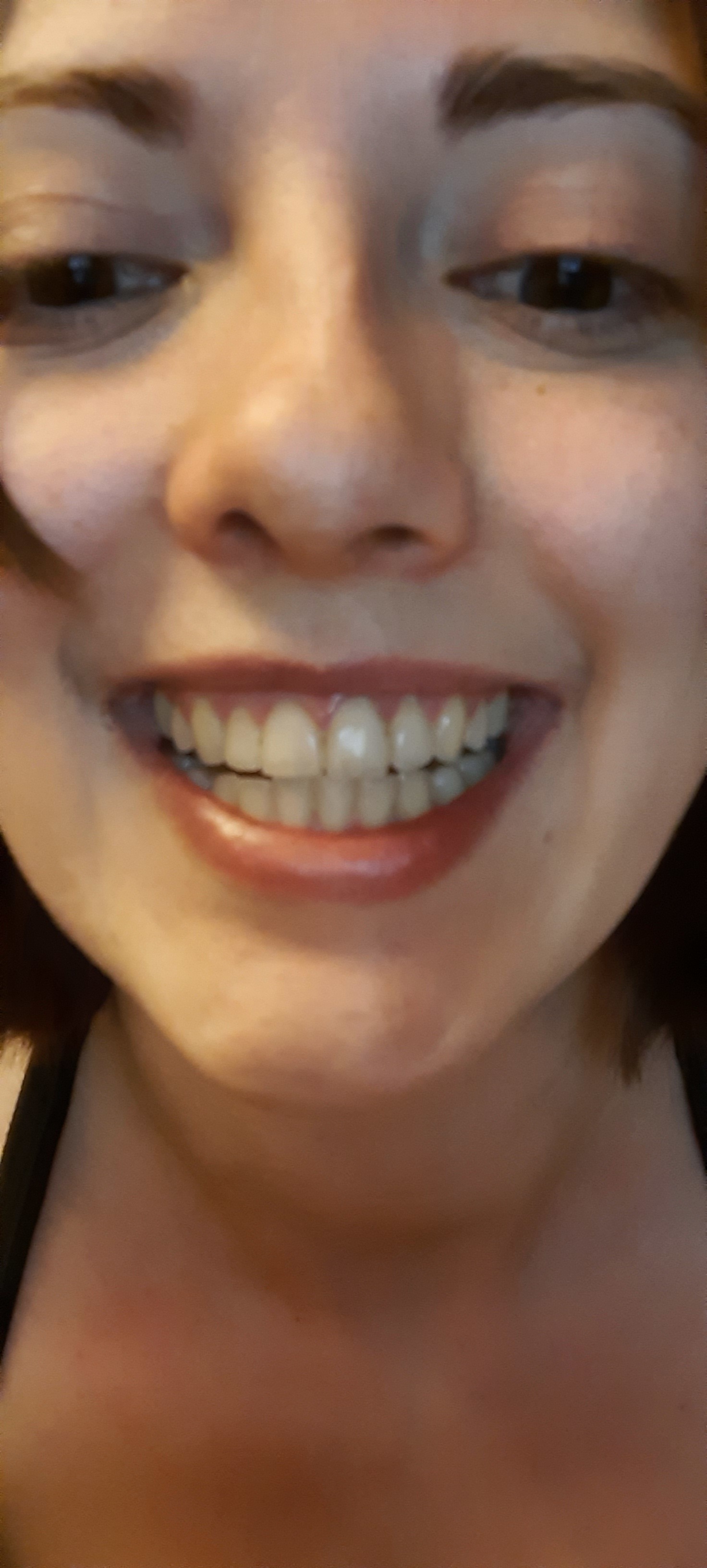 TEETH GIRL OnlyFans header