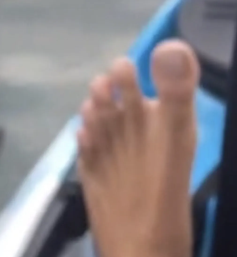 oside toes