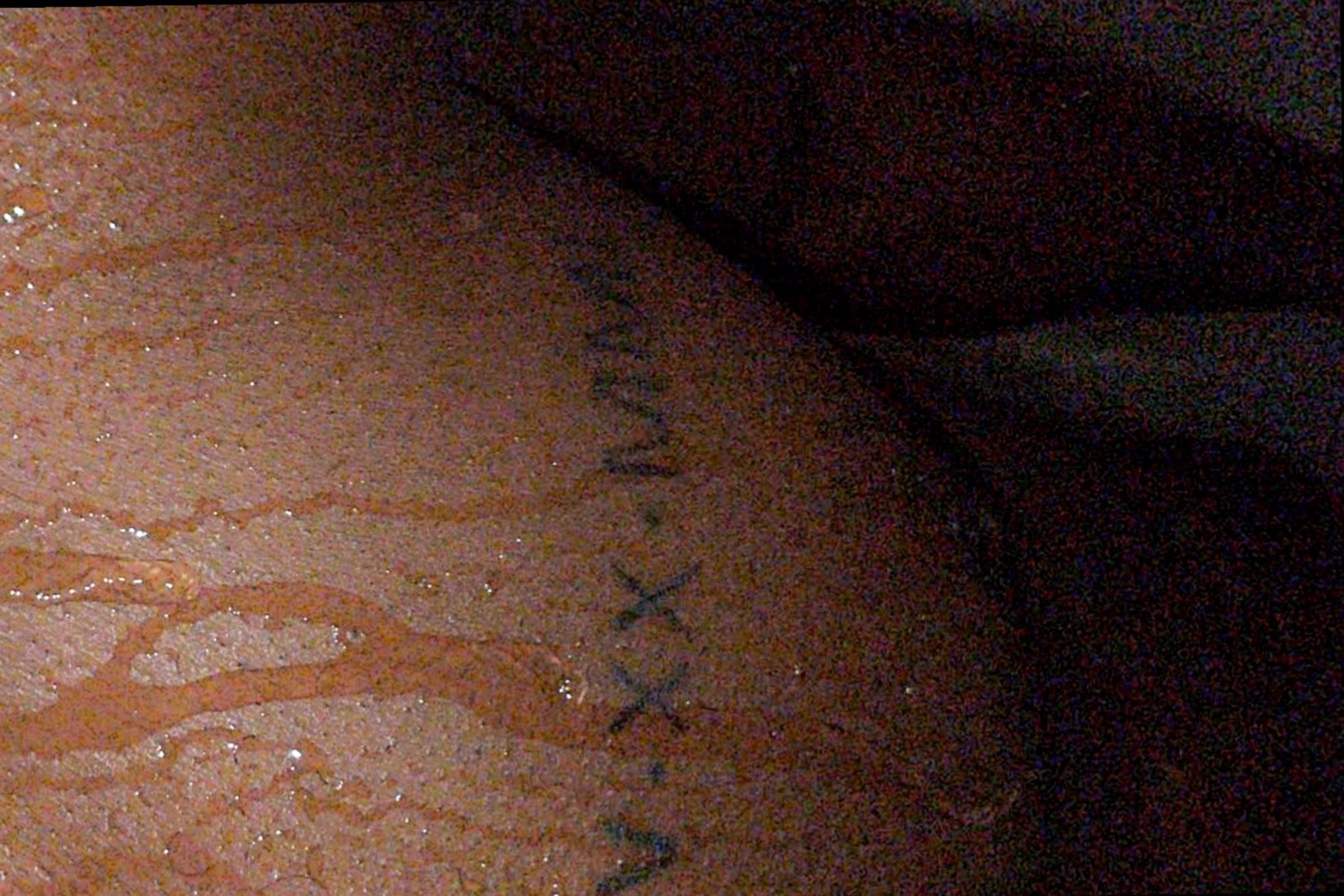 ostin OnlyFans header