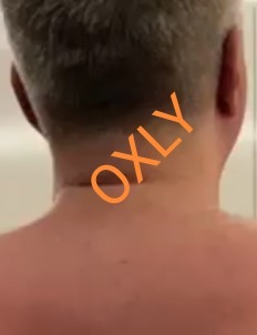 OXLY OnlyFans