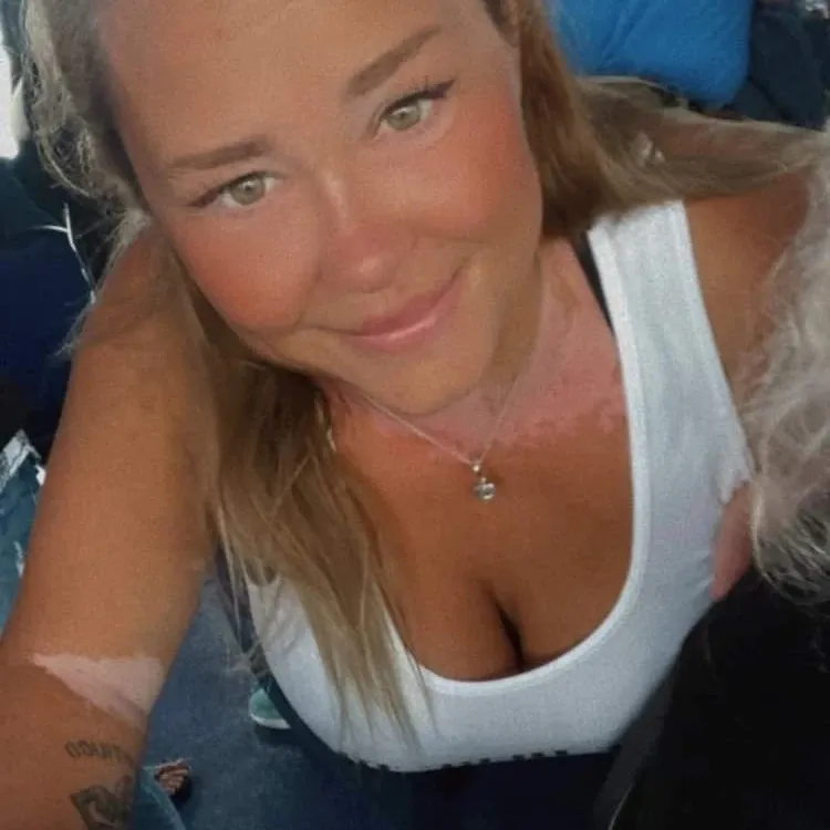 Vitiligo Feet OnlyFans header