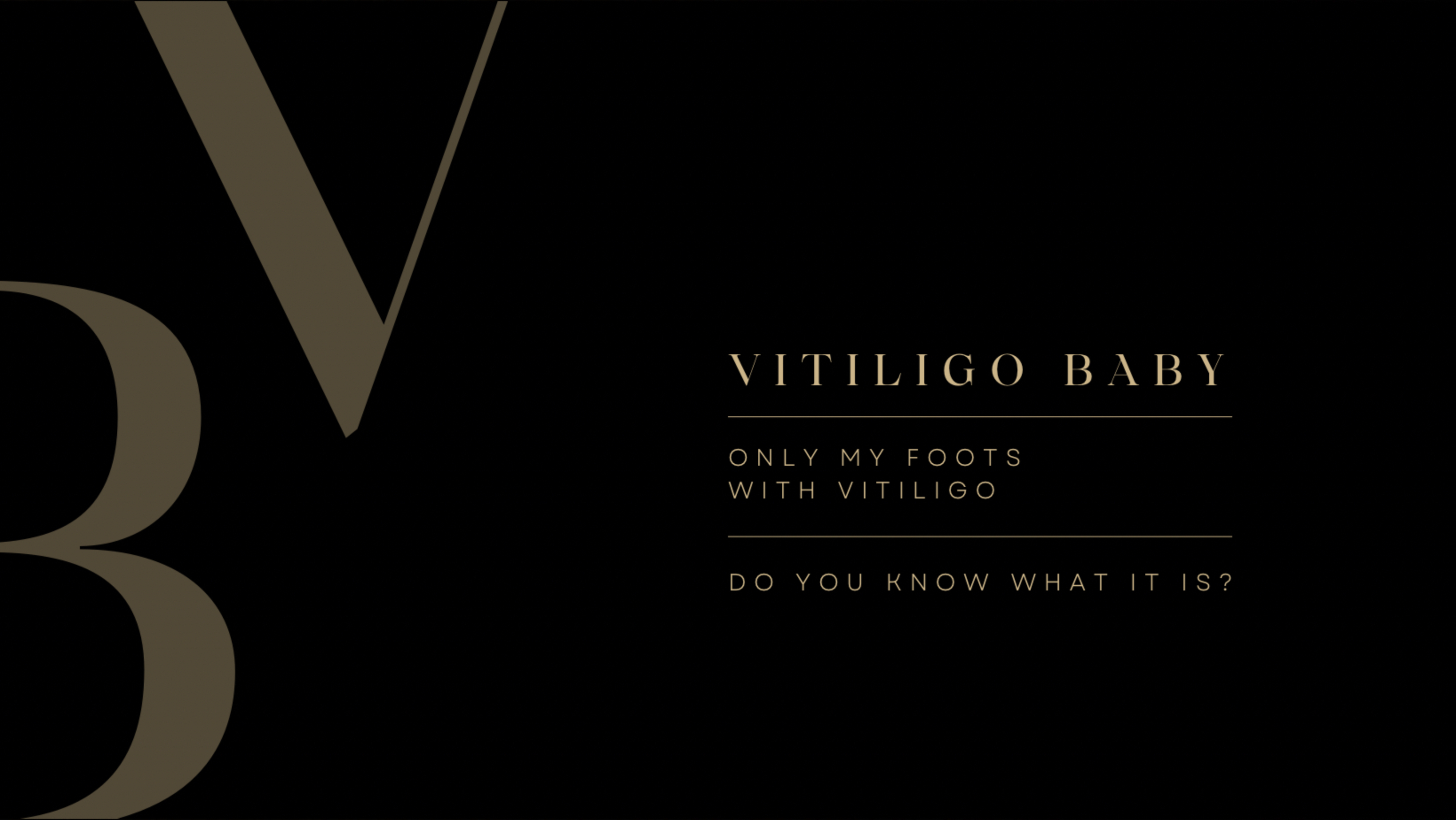 vitiligo baby. OnlyFans header