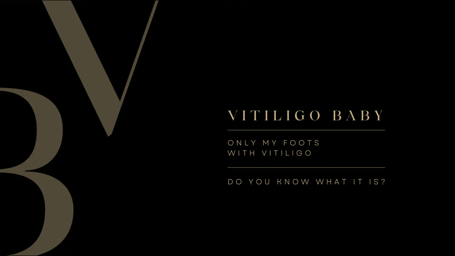 vitiligo baby. OnlyFans header