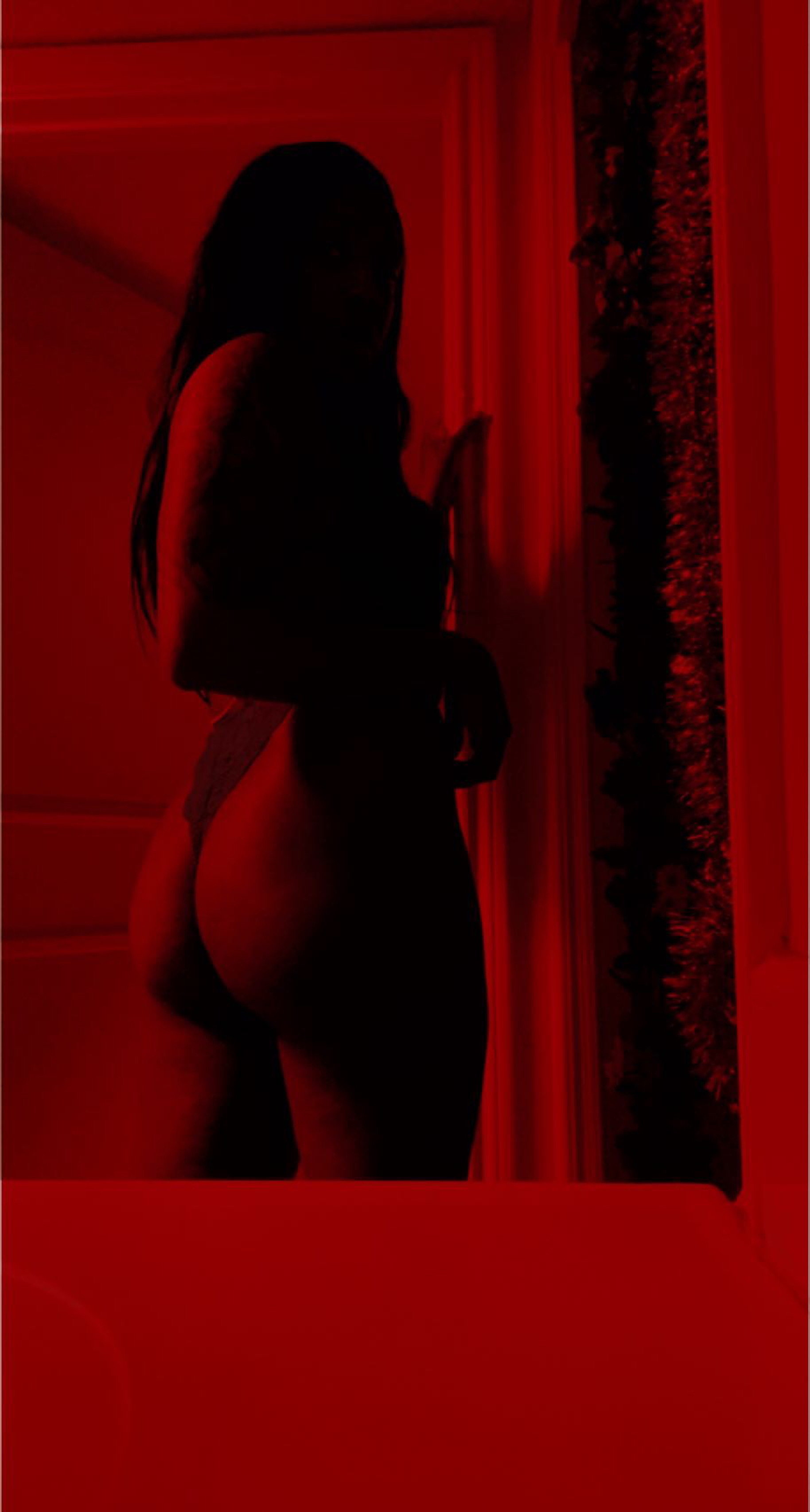 Vitiligo Bae OnlyFans