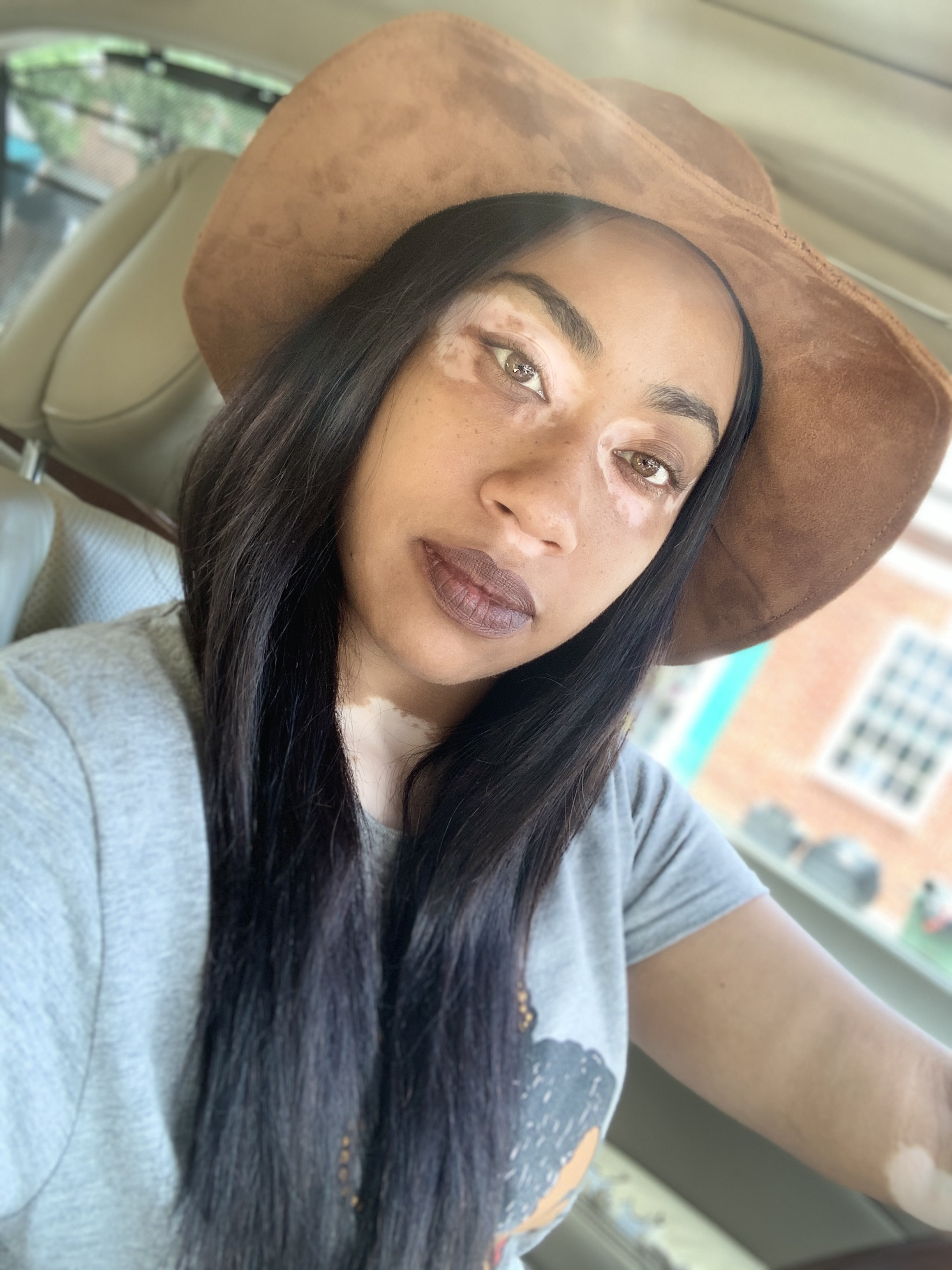 Vitiligo Fox OnlyFans header