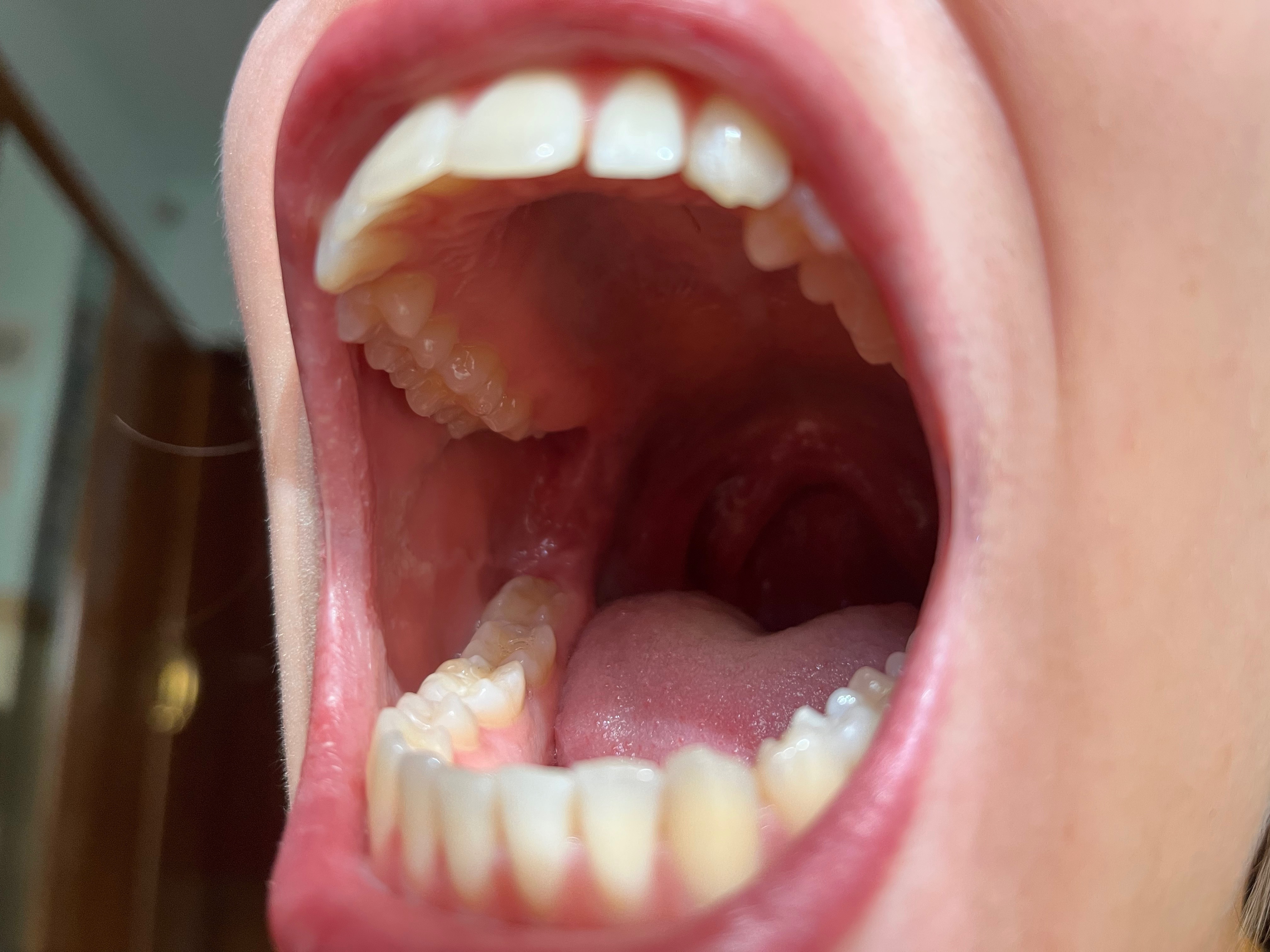 Elixs Vore OnlyFans header