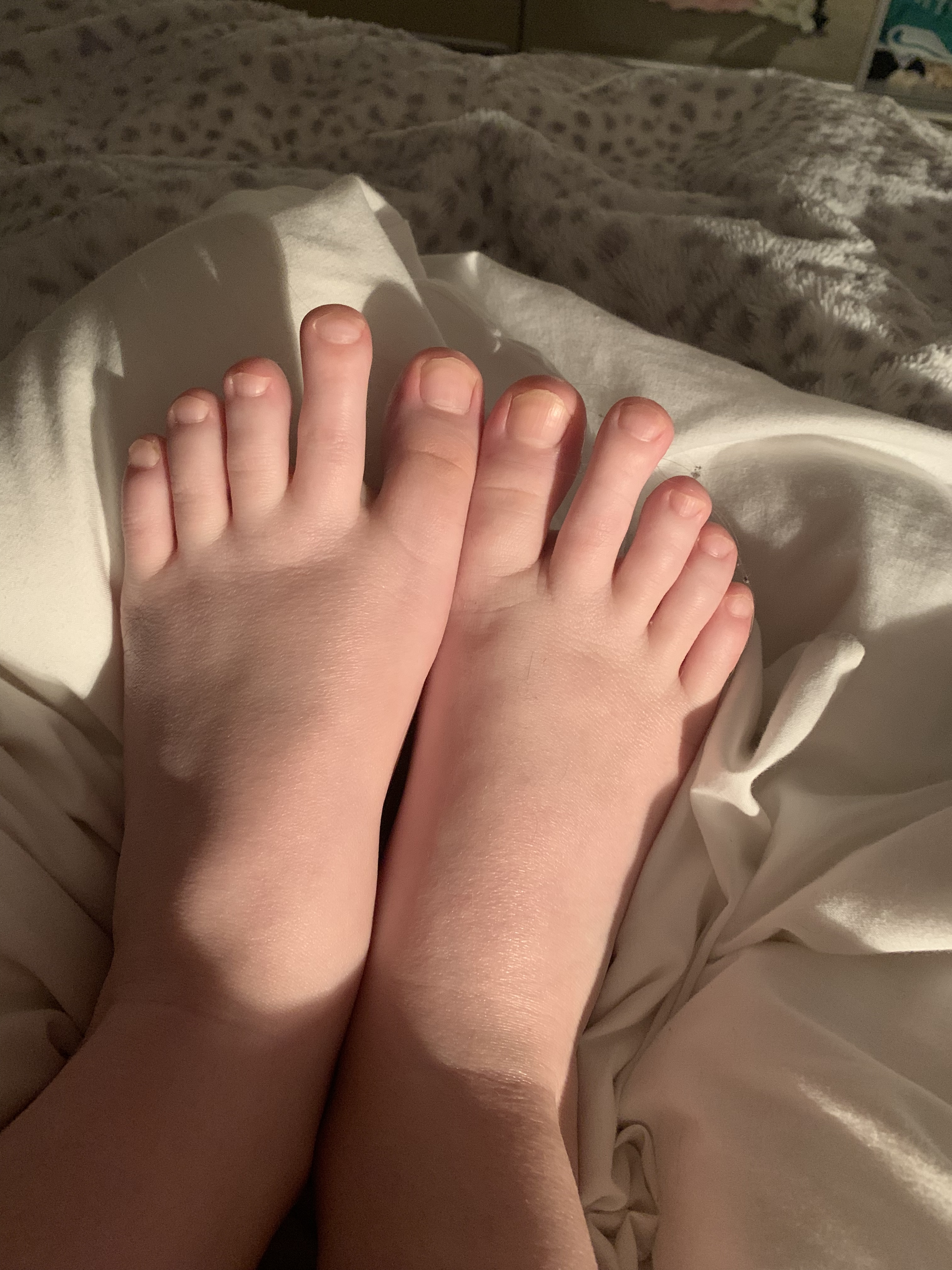 weirdfeet OnlyFans