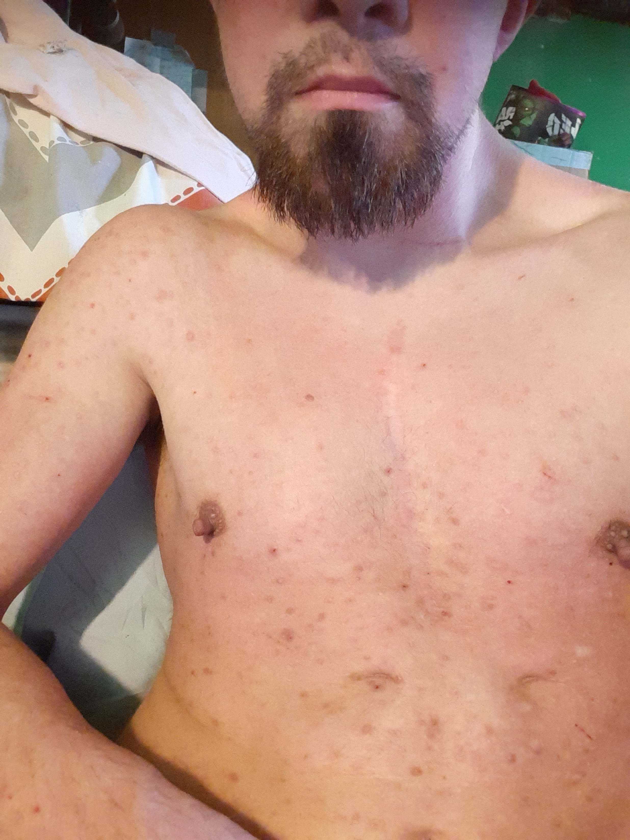 Wolf Sketch OnlyFans