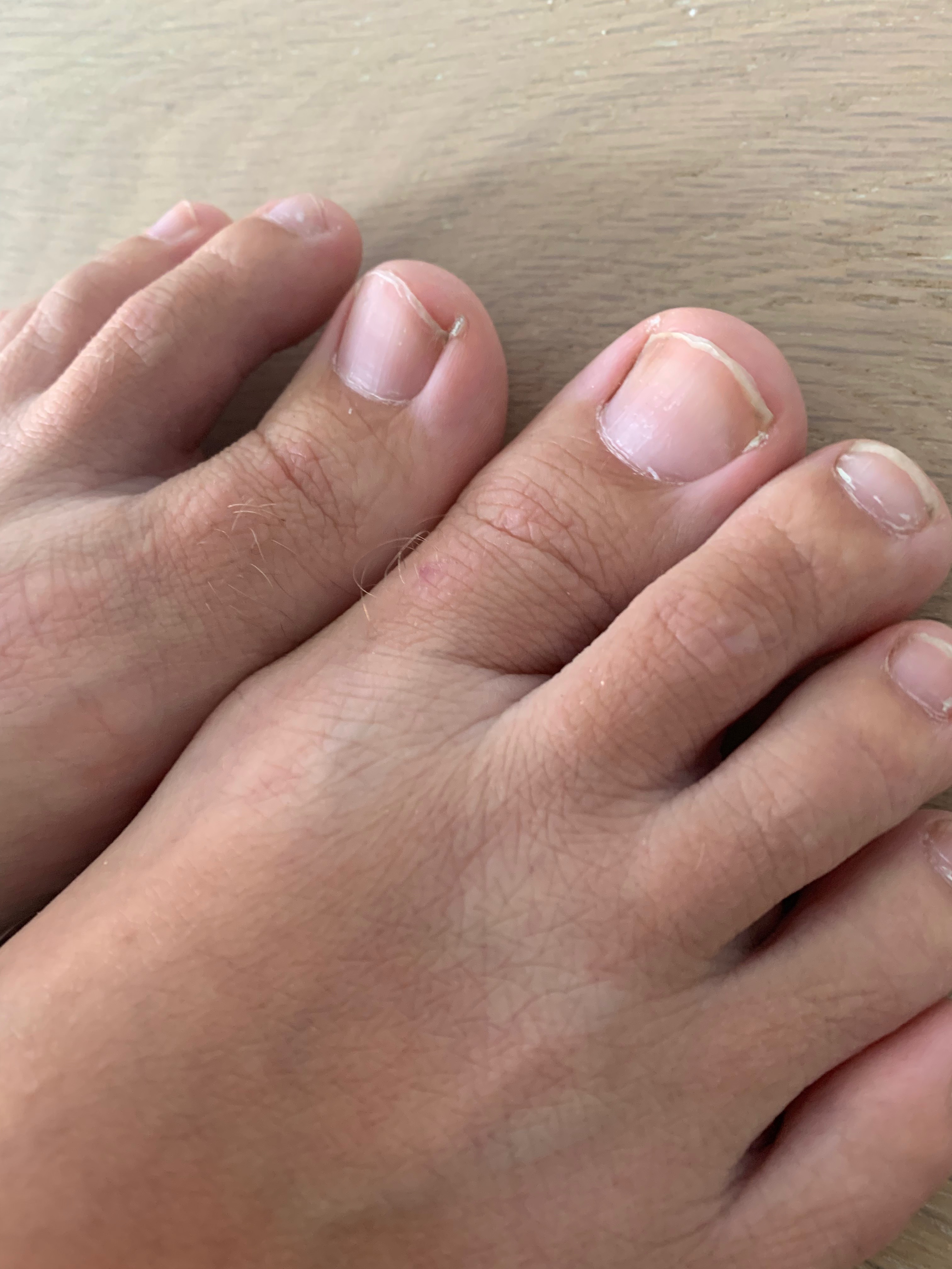 Foot Fantasy OnlyFans